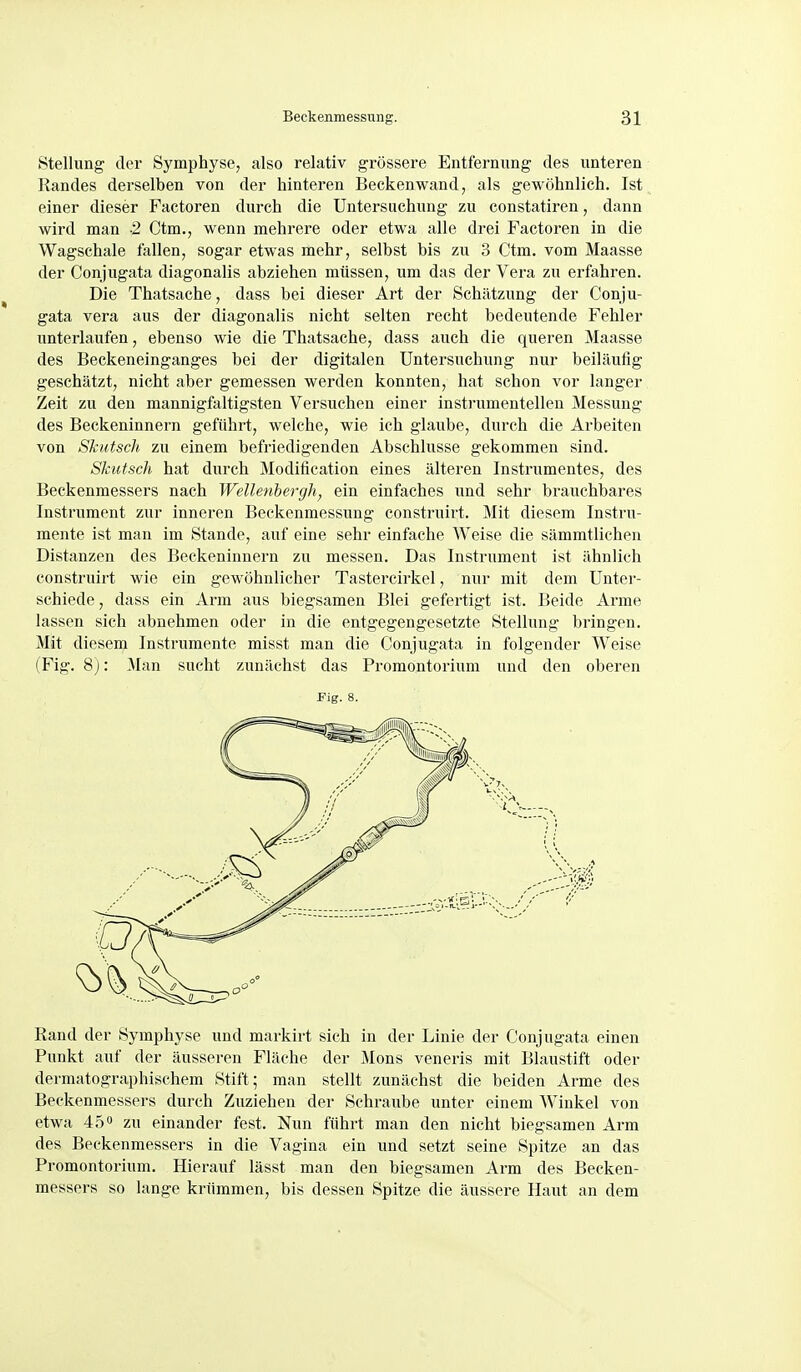 Stellung der Symphyse, also relativ grössere Entfernung des unteren Randes derselben von der hinteren Beckenwand, als gewöhnlich. Ist einer dieser Factoren durch die Untersuchung zu constatiren, dann wird man -2 Ctm., wenn mehrere oder etwa alle drei Factoren in die Wagschale fallen, sogar etwas mehr, selbst bis zu 3 Ctm. vom Maasse der Conjugata diagonalis abziehen müssen, um das der Vera zu erfahren. Die Thatsache, dass bei dieser Art der Schätzung der Conju- gata vera aus der diagonalis nicht selten recht bedeutende Fehler unterlaufen, ebenso wie die Thatsache, dass auch die queren Maasse des Beckeneinganges bei der digitalen Untersuchung nur beiläufig geschätzt, nicht aber gemessen werden konnten, hat schon vor langer Zeit zu den mannigfaltigsten Versuchen einer instrumentellen Messung des Beckeninnern geführt, welche, wie ich glaube, durch die Arbeiten von Skutsch zu einem befriedigenden Abschlüsse gekommen sind. Skutsch hat durch Modification eines älteren Instrumentes, des Beckenmessers nach Wellenhergh, ein einfaches und sehr brauchbares Instrument zur inneren Beckenmessung construirt. Mit diesem Instru- mente ist man im Stande, auf eine sehr einfache Weise die sämmtlichen Distanzen des Beckeninnern zu messen. Das Instrument ist ähnlich construirt wie ein gewöhnlicher Tastercirkel, nur mit dem Unter- schiede, dass ein Arm aus biegsamen Blei gefertigt ist. Beide Arme lassen sich abnehmen oder in die entgegengesetzte Stellung bringen. Mit diesem Instrumente misst man die Conjugata in folgender Weise (Fig. 8j: .Man sucht zunächst das Promontorium und den oberen Fig. 8. Rand der Symjjhyse und markirt sich in der Linie der Conjugata einen Punkt auf der äusseren Fläche der Möns veneris mit Blaustift oder dermatographischem Stift; man stellt zunächst die beiden Arme des Beckenmessers durch Zuziehen der Schraube unter einem Winkel von etwa 45 zu einander fest. Nun führt man den nicht biegsamen Arm des Beckenmessers in die Vagina ein und setzt seine Spitze an das Promontorium. Hierauf lässt man den biegsamen Arm des Becken- messers so lange krümmen, bis dessen Spitze die äussere Haut an dem