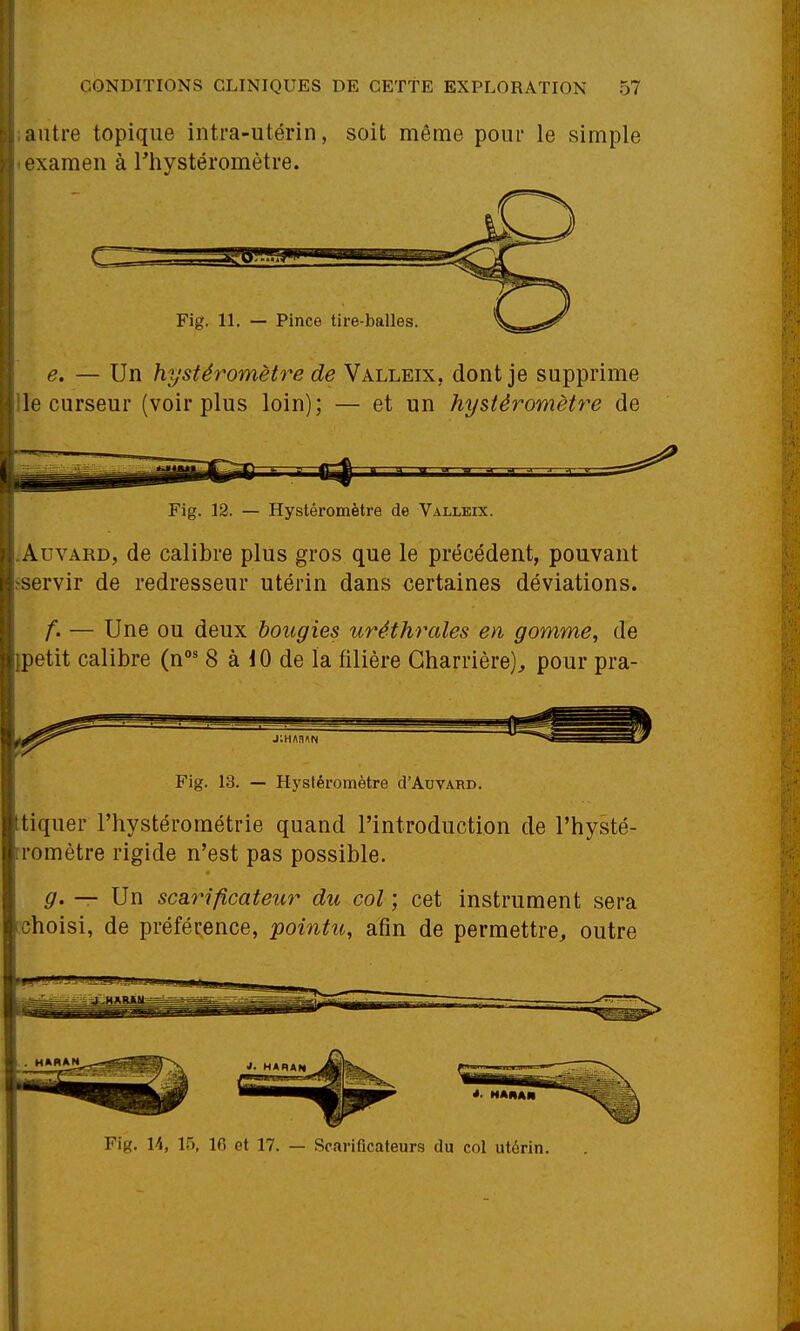 autre topique intra-utérin, soit même pour le simple examen à riiystéromètre. Fig. 11. — Pince tire-balles e. — Un hystéromètre de Valleix, dont je supprime le curseur (voir plus loin); — et un hystéromètre de Fig. 12. — Hystéromètre de Valleix. AuvARD, de calibre plus gros que le précédent, pouvant servir de redresseur utérin dans certaines déviations. — Une ou deux bougies uréthrales en gomme, de petit calibre (n' 8 à 10 de la filière Gharrière)^ pour pra- Fig. 13. — Hystéromètre (J'Auvard. tiquer l'hystérométrie quand l'introduction de l'hysté- romètre rigide n'est pas possible. g' — Un scarificateur du col ; cet instrument sera choisi, de préférence, pointu, afin de permettre^ outre HARAN *. HAIIAII Fig. U, 15, ifi et 17. — Scariflcateurs du col utérin.