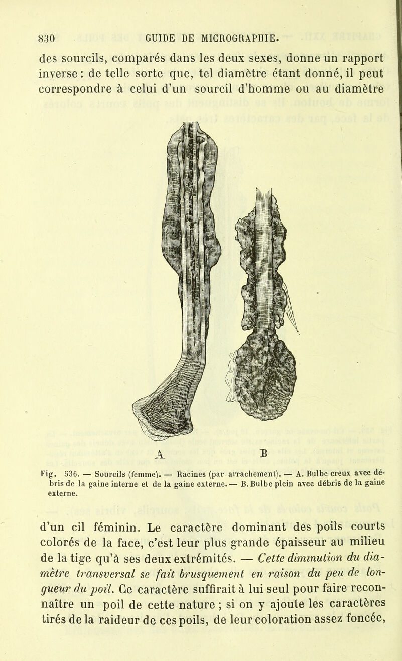 des sourcils, comparés dans les deux sexes, donne un rapport inverse : de telle sorte que, tel diamètre étant donné, il peut correspondre à celui d’un sourcil d’homme ou au diamètre Fig. 536. — Sourcils (femme}. — Racines (par arrachement). — A. Bulbe creux avec dé- bris de la gaine interne et de la gaine externe.— B. Bulbe plein avec débris de la gaine externe. d’un cil féminin. Le caractère dominant des poils courts colorés de la face, c’est leur plus grande épaisseur au milieu de la tige qu’à ses deux extrémités. — Cette diminution du dia- mètre transversal se fait brusquement en raison du peu de lon- gueur du poil. Ce caractère suffirait à lui seul pour faire recon- naître un poil de cette nature ; si on y ajoute les caractères tirés de la raideur de ces poils, de leur coloration assez foncée,