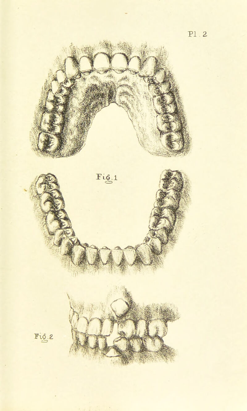 PI. 2