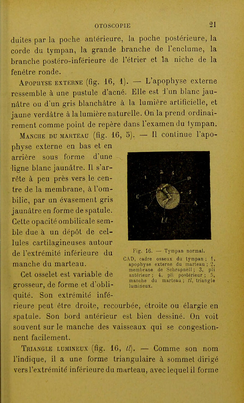 duiles par la poche antérieure, la poche postérieure, la corde du tympan, la grande branche de l'enclume, la branche postéro-inférieure de rétrier et la niche de la fenêtre ronde. Apophyse externe (fig. 16, 1). — L'apophyse externe ressemble à une pustule d'acné. Elle est d'un blanc jau- nâtre ou d'un gris blanchâtre à la lumière artificielle, et jaune verdâtre à la lumière naturelle. On la prend ordinai- rement comme point de repère dans l'examen du tympan. Manche du marteau (fig. 16, 5). — il continue l'apo- physe externe en bas et en arrière sous forme d'une ligne blanc jaunâtre. Il s'ar- rête à peu près vers le cen- tre de la membrane, à l'om- bilic, par un évasement gris jaunâtre en forme de spatule. Cette opacité ombilicale sem- ble due à un dépôt de cel- lules cartilagineuses autour de l'extrémité inférieure du manche du marteau. Cet osselet est variable de grosseur, de forme et d'obli- quité. Son extrémité infé- rieure peut être droite, recourbée, étroite ou élargie en spatule. Son bord antérieur est bien dessiné. On voit souvent sur le manche des vaisseaux qui se congestion- nent facilement. Triangle lumineux (fig. 16, II). — Comme son nom l'indique, il a une forme triangulaire à sommet dirigé versl'extrémité inférieure du marteau, avec lequel il forme Fig. 16. — Tympan normal. CAD, cadre osseux du tympan; 1, apophyse externe du marteau ; '2, membrane de Schrapnell ; 3, pli antérieur ; 4, pli postérieur ; fi, manche du marteau ; tl, triangle lumineux.
