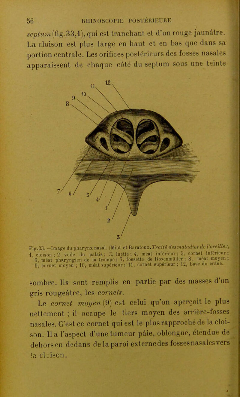 septum(Rg.33,1), qui est tranchant et d'un rouge jaunâtre. La cloison est plus large en haut et en bas que dans sa portion centrale. Les orifices postérieurs des fosses nasales apparaissent de chaque côté du septum sous une teinte Fig.33. -Image du pharynx nasal. (Miot et Baratoux.7>m'té desmaladies de l'oreille.-, 1, cloison; 2, voile du palais; S, luette; 4, méat inférieur; 5, cornet inférieur; 6, méat pharyngien de la trompe ; 7, fossette de Hopcnmûller ; 8, méat moyen ; 9, cornet moyen ; 10, méat supérieur ; 11, cornet supérieur; 12, base du crâne. sombre. Ils sont remplis en partie par des masses d'un gris rougeâtre, les cornets. Le cornet moyen (9) est celui qu'on aperçoit le plus nettement ; il occupe le tiers moyen des arrière-fosses nasales. C'est ce cornet qui est le plus rapproché de la cloi- son, lia l'aspect d'une tumeur pâie, oblongue, étendue de dehors en dedans de la paroi externe des fosses nasales vers la eleison.