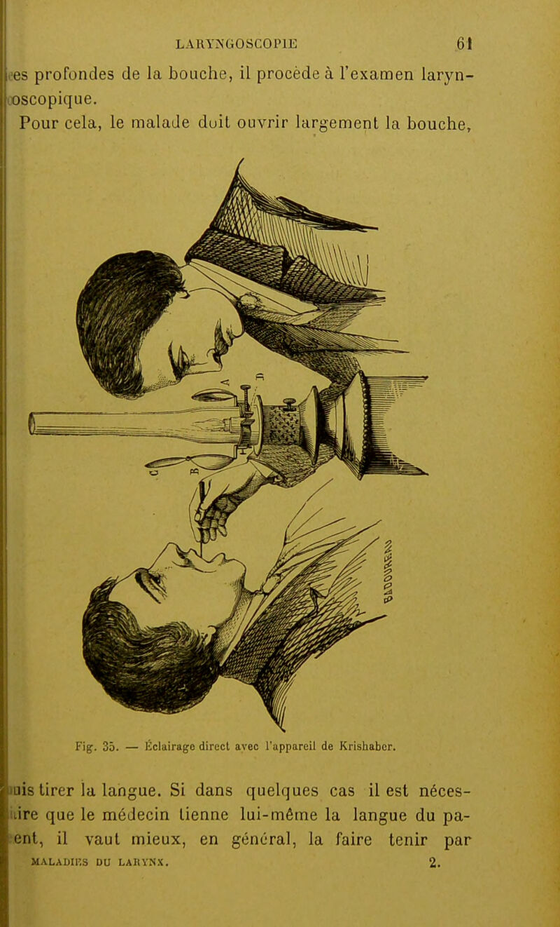 ees profondes de la bouche, il procède à l'examen laryn- cosco pique. Pour cela, le malade duit ouvrir largement la bouche, Fig. 35. — Éclairage direct avec l'appareil de Krishaber. liuis tirer la langue. Si dans quelques cas il est néces- iiire que le médecin tienne lui-même la langue du pa- ent, il vaut mieux, en général, la faire tenir par MALADIP.S DU LARYNX. 2.