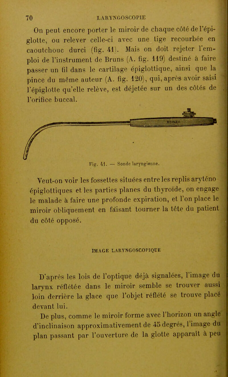 On peut encore porter le miroir de chaque côté del'épi- glotte, ou relever celle-ci avec une lige recourbée en caoutchouc durci (fig. 41). Mais on doit rejeter l'em- ploi de l'instrument de Bruns (A. fig. 119) destiné à faire passer un fil dans le cartilage épiglottique, ainsi que la pince du même auteur (A. fig. 120), qui, après avoir saisi l'épiglotte qu'elle relève, est déjetée sur un des côtés de l'orifice buccal. Fig. 41. — Sonde laryngienne. Veut-on voir les fossettes situées entre les replis aryténo épiglottiques et les parties planes du thyroïde, on engage le malade à faire une profonde expiration, et l'on place le miroir obliquement en faisant tourner la tête du patient du côté opposé. IMAGE LARYNGOSCOPIQUE D'après les lois de l'optique déjà signalées, l'image du larynx réflétée dans le miroir semble se trouver aussi loin derrière la glace que l'objet réflété se trouve placé devant lui. De plus, comme le miroir forme avec l'horizon un angle d'inclinaison approximativement de 45 degrés, l'image du plan passant par l'ouverture de la glotte apparaît à peu