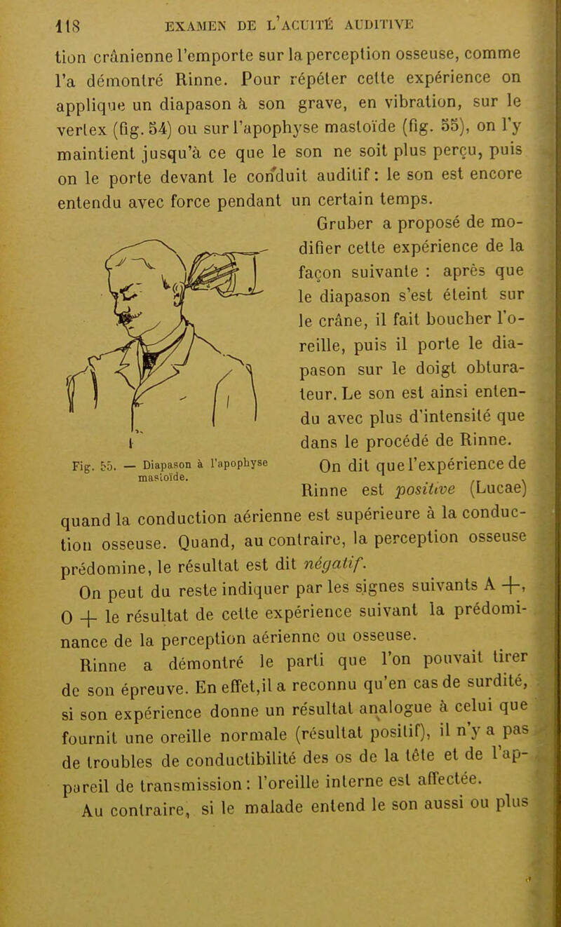 tion crânienne l'emporte sur la perception osseuse, comme l'a démontré Rinne. Pour répéter cette expérience on applique un diapason à son grave, en vibration, sur le verlex (fig. 54) ou sur l'apophyse masloïde (fig. 55), on l'y maintient jusqu'à ce que le son ne soit plus perçu, puis on le porte devant le conduit auditif: le son est encore entendu avec force pendant un certain temps. Gruber a proposé de mo- difier cette expérience de la façon suivante : après que le diapason s'est éteint sur le crâne, il fait boucher l'o- reille, puis il porte le dia- pason sur le doigt obtura- teur. Le son est ainsi enten- du avec plus d'intensité que dans le procédé de Rinne. Fig. 55. — Diapason à l'apophyse Qn que l'expérience de masloïde. Rinne est positive (Lucae) quand la conduction aérienne est supérieure à la conduc- tion osseuse. Quand, au contraire, la perception osseuse prédomine, le résultat est dit négatif. On peut du reste indiquer par les signes suivants A -f-, 0 + le résultat de cette expérience suivant la prédomi- nance de la perception aérienne ou osseuse. Rinne a démontré le parti que l'on pouvait tirer de son épreuve. En effet.il a reconnu qu'en cas de surdité, si son expérience donne un résultat analogue à celui que fournit une oreille normale (résultat positif), il n'y a pas de troubles de conductibilité des os de la tête et de l'ap- pareil de transmission: l'oreille interne est affectée. Au contraire, si le malade entend le son aussi ou plus