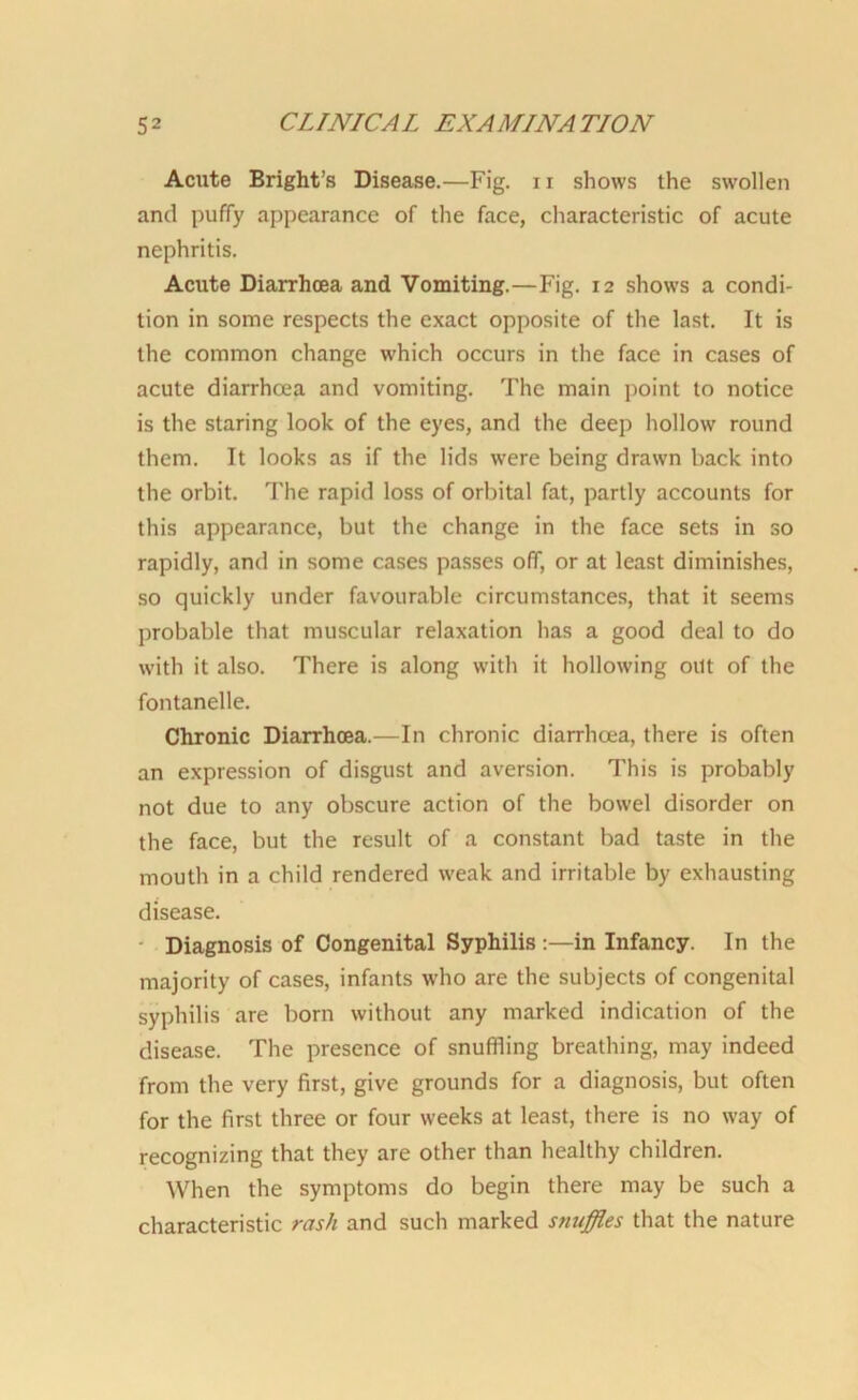 Acute Bright’s Disease.—Fig. n shows the swollen and puffy appearance of the face, characteristic of acute nephritis. Acute Diarrhoea and Vomiting.—Fig. 12 shows a condi- tion in some respects the exact opposite of the last. It is the common change which occurs in the face in cases of acute diarrhoea and vomiting. The main point to notice is the staring look of the eyes, and the deep hollow round them. It looks as if the lids were being drawn back into the orbit. The rapid loss of orbital fat, partly accounts for this appearance, but the change in the face sets in so rapidly, and in some cases passes off, or at least diminishes, so quickly under favourable circumstances, that it seems probable that muscular relaxation has a good deal to do with it also. There is along with it hollowing out of the fontanelle. Chronic Diarrhoea.—In chronic diarrhoea, there is often an expression of disgust and aversion. This is probably not due to any obscure action of the bowel disorder on the face, but the result of a constant bad taste in the mouth in a child rendered weak and irritable by exhausting disease. Diagnosis of Congenital Syphilis :—in Infancy. In the majority of cases, infants who are the subjects of congenital syphilis are born without any marked indication of the disease. The presence of snuffling breathing, may indeed from the very first, give grounds for a diagnosis, but often for the first three or four weeks at least, there is no way of recognizing that they are other than healthy children. When the symptoms do begin there may be such a characteristic rash and such marked snuffles that the nature