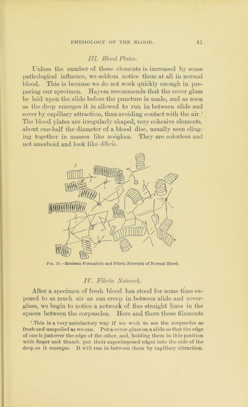 III. Blood Plates. Unless the number of these elements is increased b}'- some pathological influence, we seldom notice them at all in normal blood. This is because we do not work quickly enough in i^re- paring our specimen. Hayeni recommends that the cover glass be laid ui)on the slide before the puncture is made, and as soon as the drop emerges it is allowed to run in between slide and cover by capillary attraction, thus avoiding contact with the air.' The blood plates are irregularly shaj^ed, very cohesive elements, about one-half the'diameter of a blood disc, usually seen cling- ing together in masses like zobgloea. They are colorless and not amoeboid and look like debris. Fig. 15.—Rouleau Formation and Fibrin Network of Normal Blood. TV. Fibrin Network. After a specimen of fresh blood has stood for some time ex- posed to as much air as can creej) in between slide and cover- glass, we begin to notice a network of fine straight lines in the spaces between the corpuscles. Here and there these filaments • This is a very satisfactory way if we wish to see the corpuscles as fresh and unspoiled as we can. Put a cover-glass on a slide so that the edge of one is justover the edge of the other, and, holding them in this position with finger and thumb, put their superimposed edges into the side of the drop as it emerges. It will run in between them by capillary attraction.
