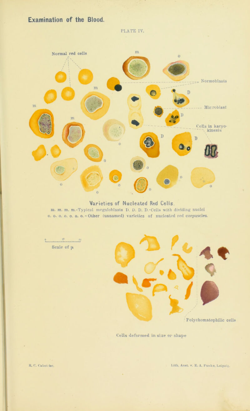 Examination of the Blood. PLATE IV. Varieties of Nucleated Red Cells. m. m. m. m.-Typical megaloblasts 1). U. D. D.-Cells witli di\idinf? nuclei o. 0. 0. 0. o. 0. o. = Other (unnamed) varieties of nucleated red corpuscles. o Scale of [Ji Cells deformed in size or shape R. r. Cabot fee. Lith, Anst. r. E. A.. Fuiiko, Leipxi^.