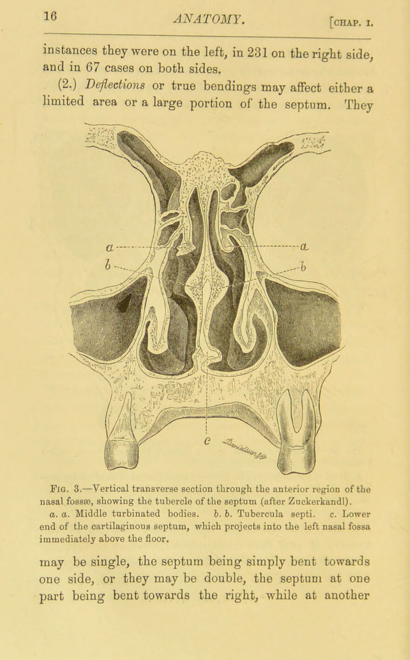 10 [chap. I. instances they were on the left, in 231 on the right side, and in 67 cases on both sides. (2.) Deflections or true bendings may affect either a limited area or a large portion of the septum. They Fig. 3.—Vertical transverse section through the anterior region of the nasal fossae, showing the tubercle of the septum (after Zuckerkandl). a. a. Middle turbinated bodies. b. b. Tubercula septi. c. Lower end of the cartilaginous septum, which projects into the left nasal fossa immediately above the floor. may be single, the septum being simply bent towards one side, or they may be double, the septum at one part being bent towards the right, while at another