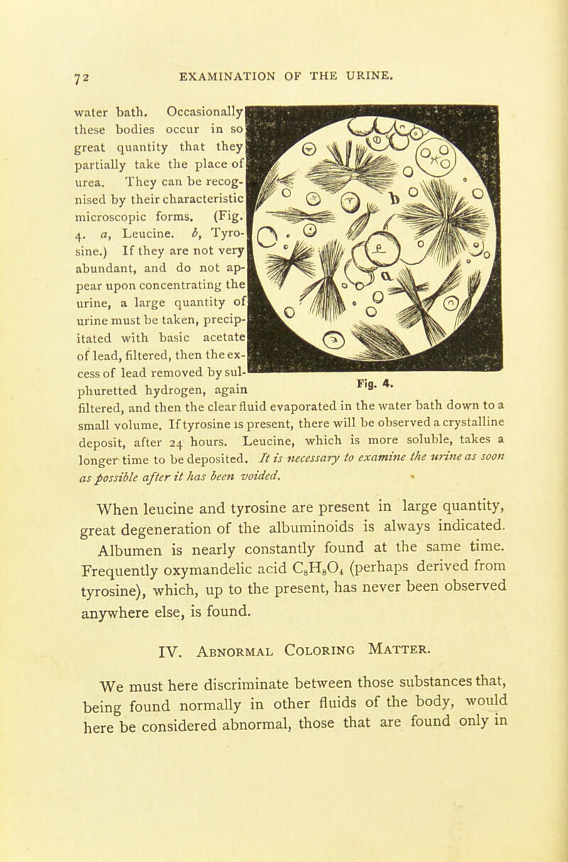 water bath. Occasionally! these bodies occur in so great quantity that they partially take the place of I urea. They can be recog- nised by their characteristic! microscopic forms. (Fig. 4. a. Leucine, b. Tyro-1 sine.) If they are not very abundant, and do not ap- pear upon concentrating the] urine, a large quantity ofj urine must be taken, precip- itated with basic acetatel of lead, filtered, then the ex- cess of lead removed bysul-' phuretted hydrogen, again Fig. 4. filtered, and then the clear fluid evaporated in the water bath down to a small volume. If tyrosine is present, there will be observed a crystalline deposit, after 24 hours. Leucine, which is more soluble, takes a longer time to be deposited. It is necessary to examine the urine as soon as possible after it has been voided. When leucine and tyrosine are present in large quantity, great degeneration of the albuminoids is always indicated. Albumen is nearly constantly found at the same time. Frequently oxymandelic acid CgHsO* (perhaps derived from tyrosine), which, up to the present, has never been observed anywhere else, is found. IV. Abnormal Coloring Matter. We must here discriminate between those substances that, being found normally in other fluids of the body, would here be considered abnormal, those that are found only in