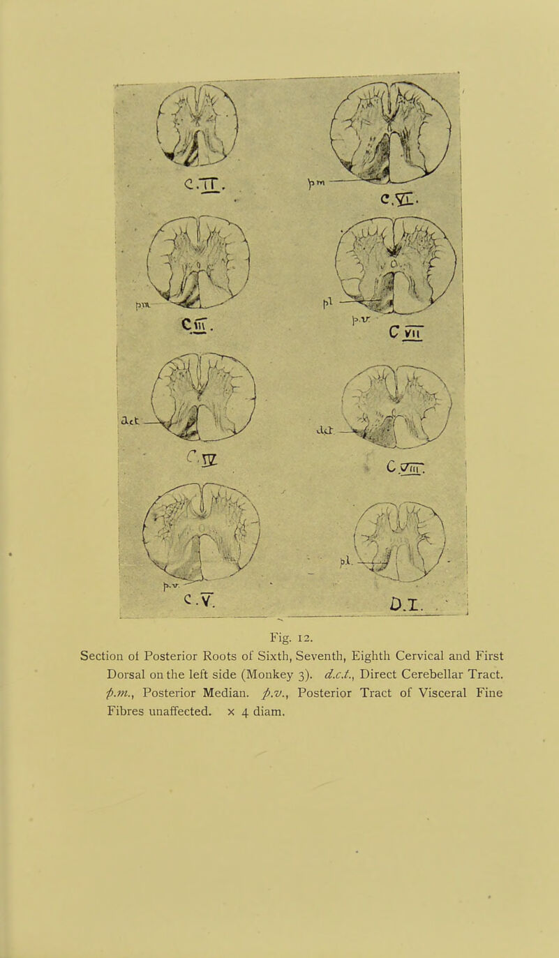 Fig. 12. Section of Posterior Roots of Sixtli, Seventh, Eighth Cervical and First Dorsal on the left side (Monkey 3). d.c.t.^ Direct Cerebellar Tract. f.ni., Posterior Median, p.v., Posterior Tract of Visceral Fine Fibres unaffected, x 4 diam.