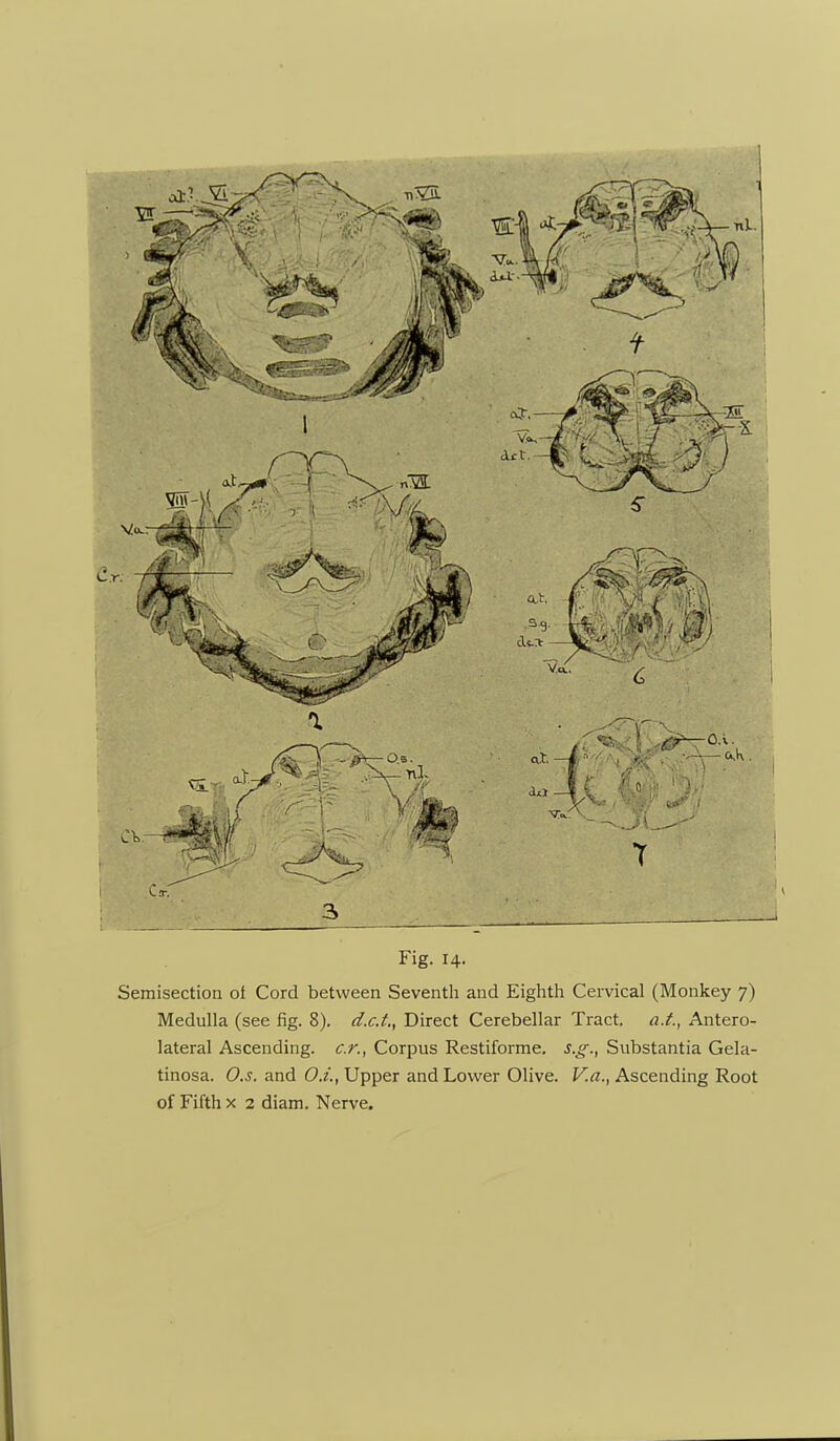 Medulla (see fig. 8). d.c.t,^ Direct Cerebellar Tract, a.t., Antero- lateral Ascending, c.r.^ Corpus Restiforme, s.g., Substantia Gela- tinosa. O.s. and O.i., Upper and Lower Olive. V.a., Ascending Root of Fifth X 2 diam. Nerve.