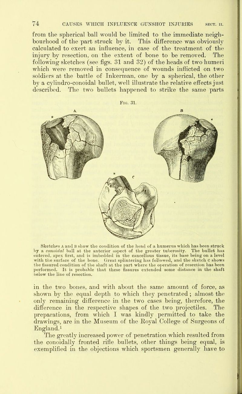 from the spherical ball would be limited to the immediate neigh- bourhood of the part struck by it. This difference was obviously calculated to exert an influence, in case of the treatment of the injury by resection, on the extent of bone to be removed. The following sketches (see figs. 31 and 32) of the heads of two humeri which were removed in consequence of wounds inflicted on two soldiers at the battle of Inkerman, one by a spherical, the other by a cylindro-conoidal bullet, well illustrate the relative effects just described. The two bullets happened to strike the same parts Fig. 31. Sketches A and B show the condition of the head of a humerus which has been struck by a conoidal ball at the anterior aspect of the greater tuberosity. The bullet has entered, apex first, and is imbedded in the cancellous tissue, its base being on a level with the surface of the bone. Great splintering has followed, and the sketch C shows the fissured condition of the shaft at the part where the operation of resection has been performed. It is probable that these fissures extended some distance in the shaft below the line of resection. in the two bones, and with about the same amount of force, as shown by the equal depth to which they penetrated ; almost the only remaining difference in the two cases being, therefore, the difference in the respective shapes of the two projectiles. The preparations, from which I was kindly permitted to take the drawings, are in the Museum of the Royal College of Surgeons of England.1 The greatly increased power of penetration which resulted from the conoidally fronted rifle bullets, other things being equal, is exemplified in the objections which sportsmen generally have to