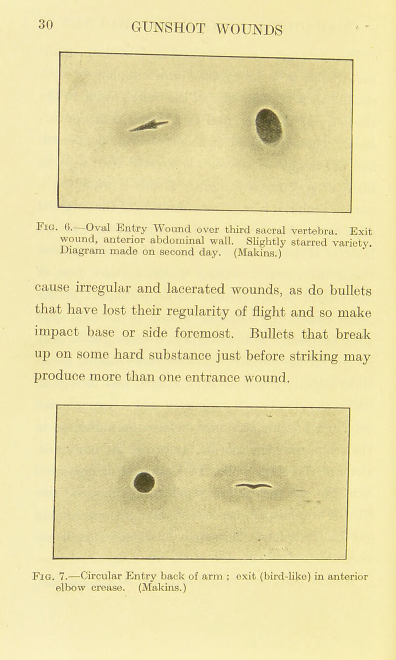 Fig. G.—Oval Entry Wound over third sacral vertebra. Exit wound, anterior abdominal wall. Slightly starred variety. Diagram made on second day. (Makins.) cause irregular and lacerated wounds, as do bullets that have lost their regularity of flight and so make impact base or side foremost. Bullets that break up on some hard substance just before striking may produce more than one entrance wound. Fig. 7.—Circular Entry back of arm ; exit (bird-like) in anterior elbow crease. (Makins.)