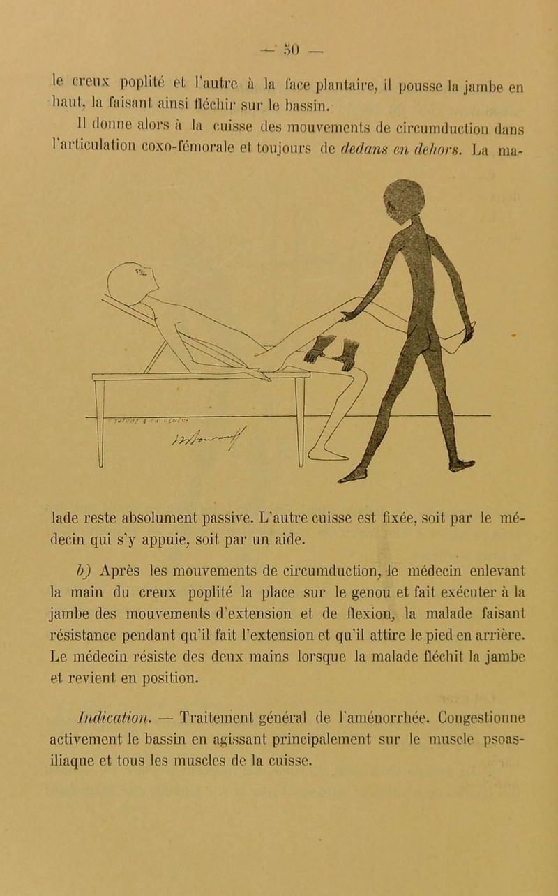 —' oO — le creux poplité et 1‘autre à la lace plantaire, il pousse la jambe en liant, la faisant ainsi llécliir sur le bassin. Il donne alors à la cuisse des mouvements de circumduction dans I articulation coxo-fémorale et toujours de dedans en dehors. La ma- lade reste absolument passive. L'autre cuisse est fixée, soit par le mé- decin qui s’y appuie, soit par un aide. h) Après les mouvements de circumduction, le médecin enlevant la main du creux poplité la place sur le genou et fait exécuter à la jambe des mouvements d’extension et de flexion, la malade faisant résistance pendant qu’il fait l’extension et qu'il attire le pied en arrière. Le médecin résiste des deux mains lorsque la malade fléchit la jambe et revient en position. Indication. — Traitement général de l'aménorrhée. Congestionne activement le bassin en agissant principalement sur le muscle psoas- iliaque et tous les muscles de la cuisse.