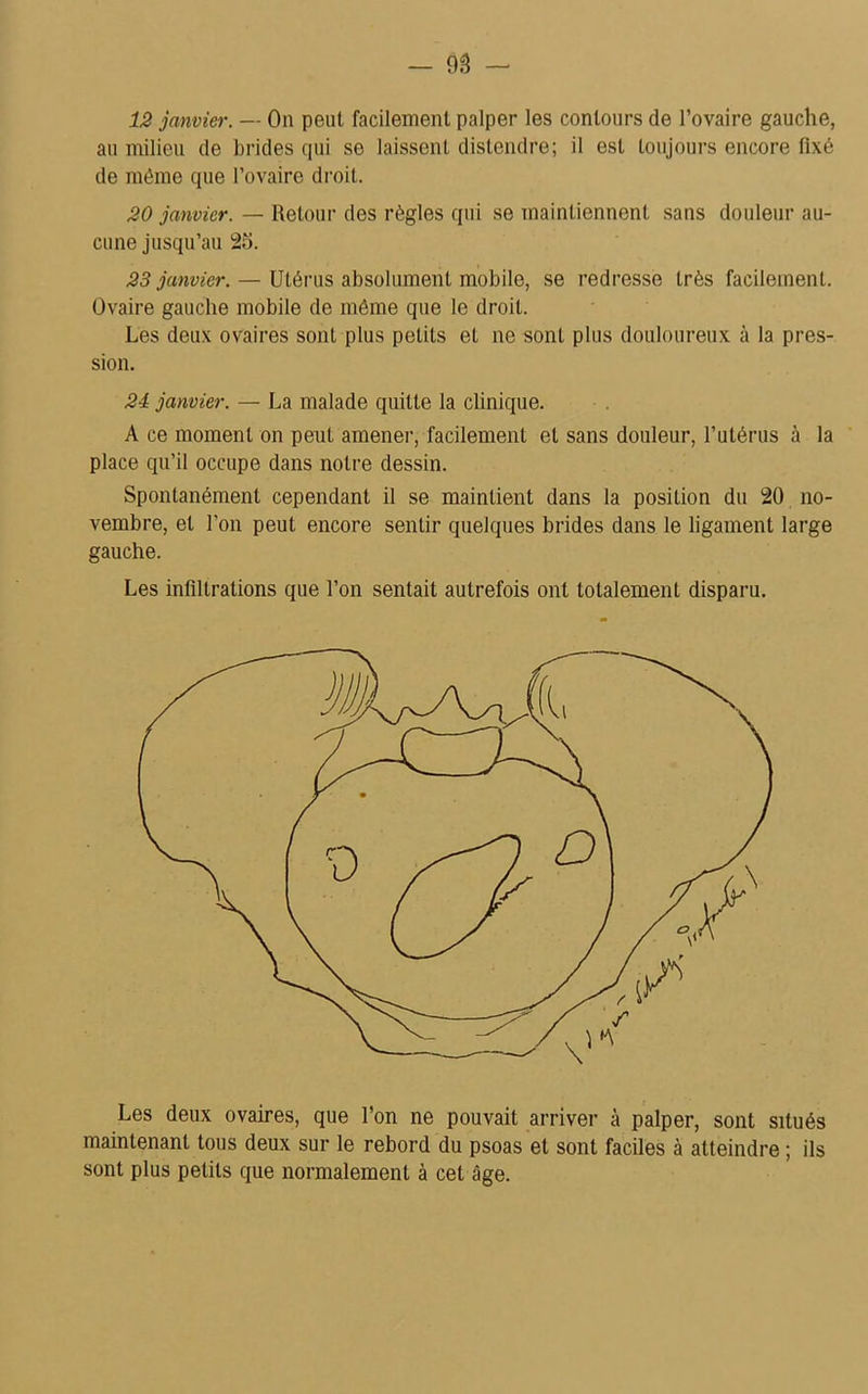 12 janvier. — On peut facilement palper les contours de l’ovaire gauche, au milieu de brides qui se laissent distendre; il est toujours encore fixé de mémo que l’ovaire droit. 20 janvier. — Retour des règles qui se maintiennent sans douleur au- cune jusqu’au 25. 23 janvier. — Utérus absolument mobile, se redresse très facilement. Ovaire gauche mobile de même que le droit. Les deux ovaires sont plus petits et ne sont plus douloureux à la pres- sion. 24 janvier. — La malade quitte la clinique. A ce moment on peut amener, facilement et sans douleur, l’utérus à la place qu’il occupe dans notre dessin. Spontanément cependant il se maintient dans la position du 20 no- vembre, et l'on peut encore sentir quelques brides dans le ligament large gauche. Les infiltrations que l’on sentait autrefois ont totalement disparu. Les deux ovaires, que l’on ne pouvait arriver à palper, sont situés maintenant tous deux sur le rebord du psoas et sont faciles à atteindre ; ils sont plus petits que normalement à cet âge.