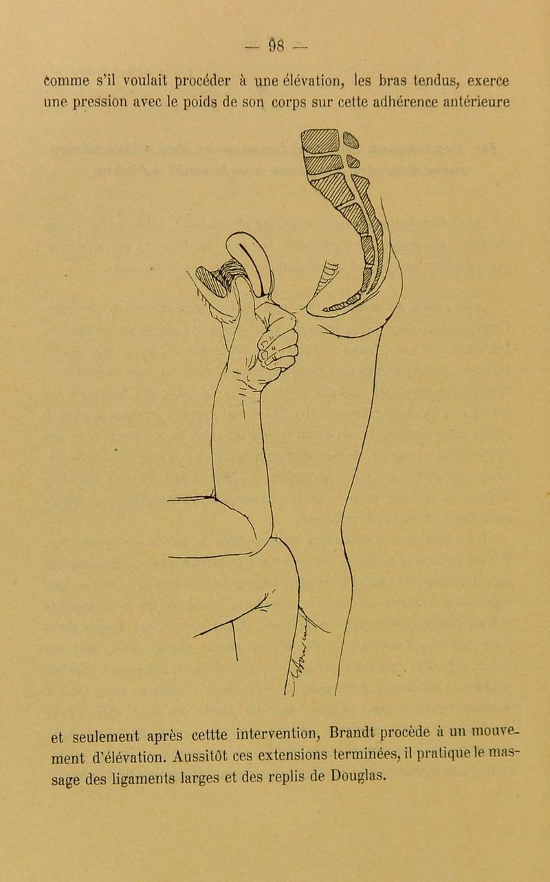 Comme s’il voulait procéder à une élévation, les bras tendus, exerce une pression avec le poids de son corps sur cette adhérence antérieure et seulement après cettte intervention, Brandt procède à un mouve- ment d’élévation. Aussitôt ces extensions terminées, il pratique le mas- sage des ligaments larges et des replis de Douglas.
