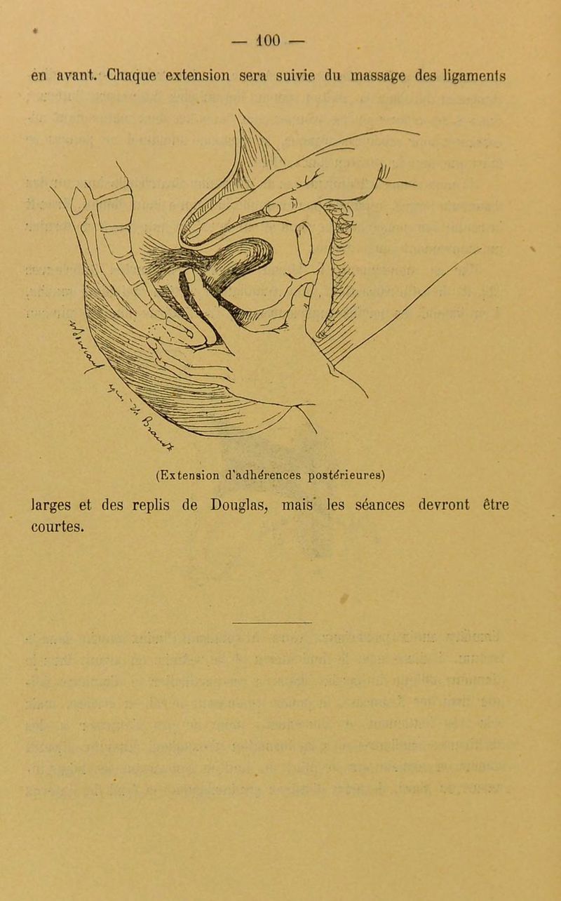 — 400 « en avant. Chaque extension sera suivie du massage des ligaments (Extension d'adhérences postérieures) larges et des replis de Douglas, mais' les séances devront être courtes.
