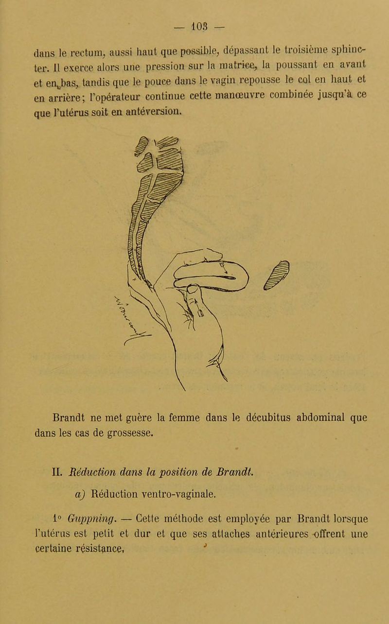 dans le rectum, aussi haut que possible, dépassant le troisième sphinc- ter. Il exerce alors une pression sur la matrice, la poussant en avant et en^bas, tandis que le pouce dans le vagin repousse le col en haut et en arrière; l’opérateur continue cette manœuvre combinée jusqu’à ce que l’utérus soit en antéversion. Brandt ne met guère la femme dans le décubitus abdominal que dans les cas de grossesse. II. Réduction dans la position de Brandt. a) Réduction ventro-vaginale. 1° Guppning. — Cette méthode est employée par Brandt lorsque l’utérus est petit et dur et que ses attaches antérieures offrent une certaine résistance, J