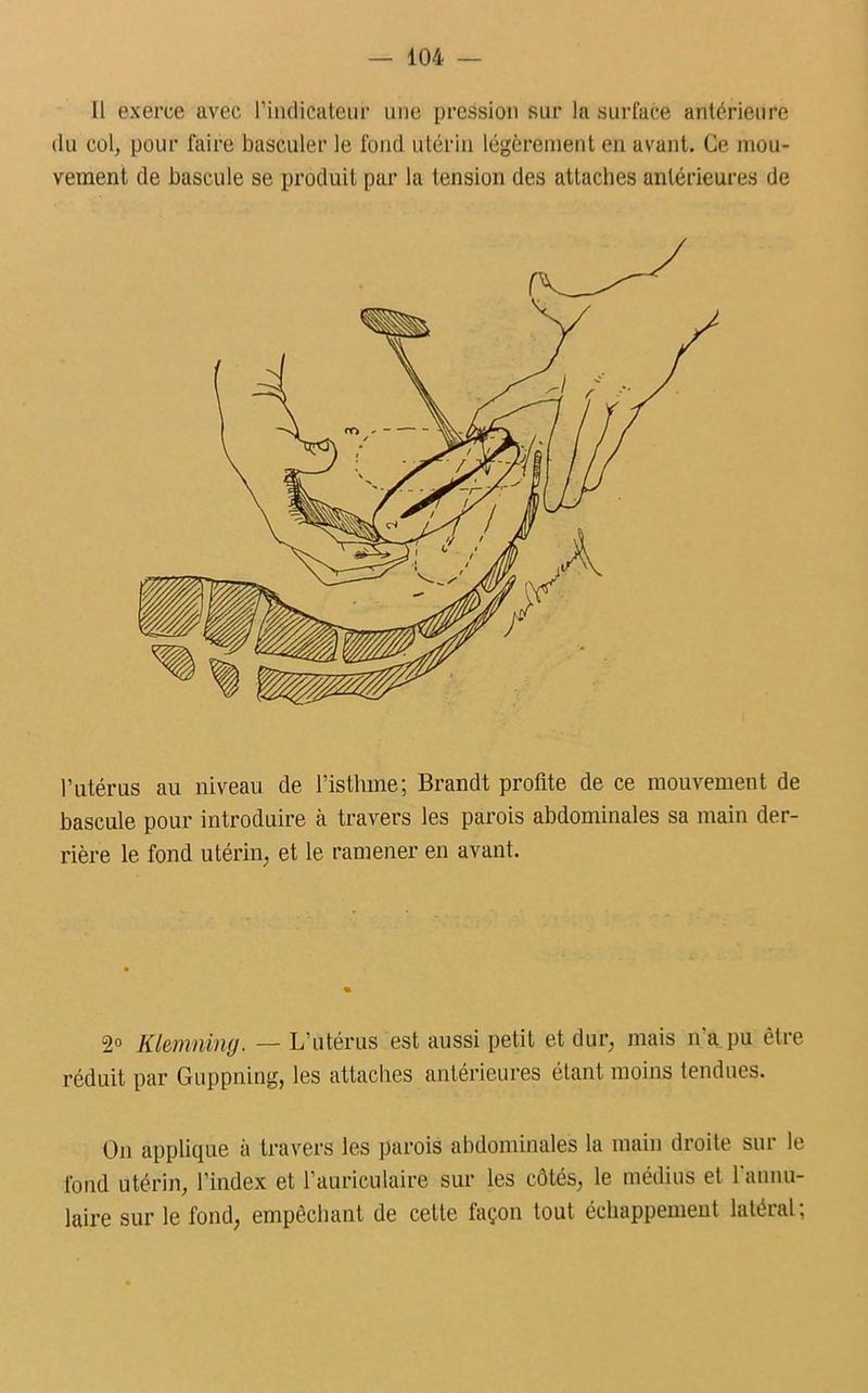 Il exerce avec l'indicateur une pression sur la surface antérieure du col, pour faire basculer le fond utérin légèrement en avant. Ce mou- vement de bascule se produit par la tension des attaches antérieures de l’utérus au niveau de l’isthme; Brandt profite de ce mouvement de bascule pour introduire à travers les parois abdominales sa main der- rière le fond utérin, et le ramener en avant. 2° Klemn&ng. — L’utérus est aussi petit et dur, mais n'a pu être réduit par Guppning, les attaches antérieures étant moins tendues. On applique à travers les parois abdominales la main droite sur le fond utérin, l’index et l’auriculaire sur les côtés, le médius et 1 annu- laire sur le fond, empêchant de cette façon tout échappement latéral;