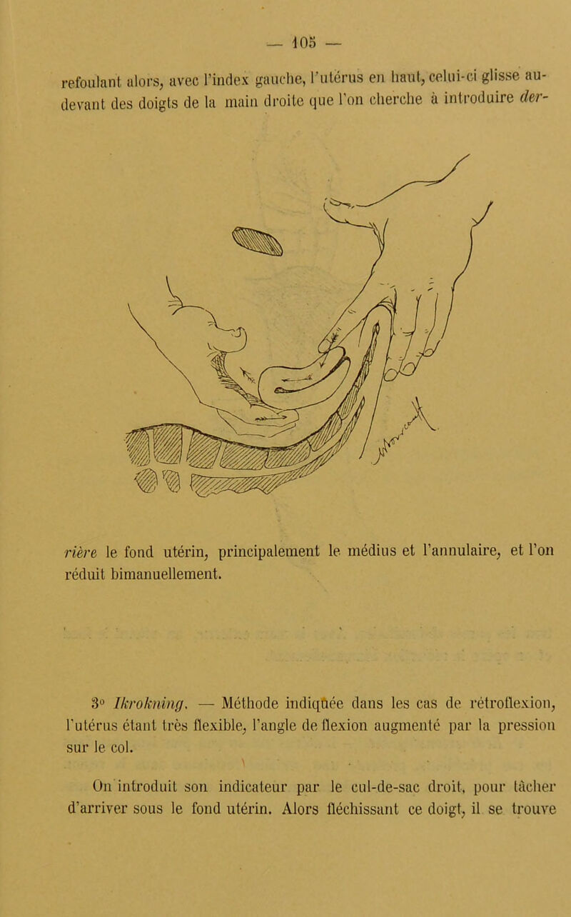 refoulant alors, avec l’index gauche, l’utérus en haut, celui-ci glisse au- devant des doigts de la main droite que l'on cherche à introduire der- rière le fond utérin, principalement le médius et l’annulaire, et l’on réduit bimanuellement. 3° Ikrokning. — Méthode indiquée dans les cas de rétroflexion, l'utérus étant très flexible, l’angle de flexion augmenté par la pression sur le col. \ • On‘introduit son indicateur par le cul-de-sac droit, pour tâcher d’arriver sous le fond utérin. Alors fléchissant ce doigt, il se trouve