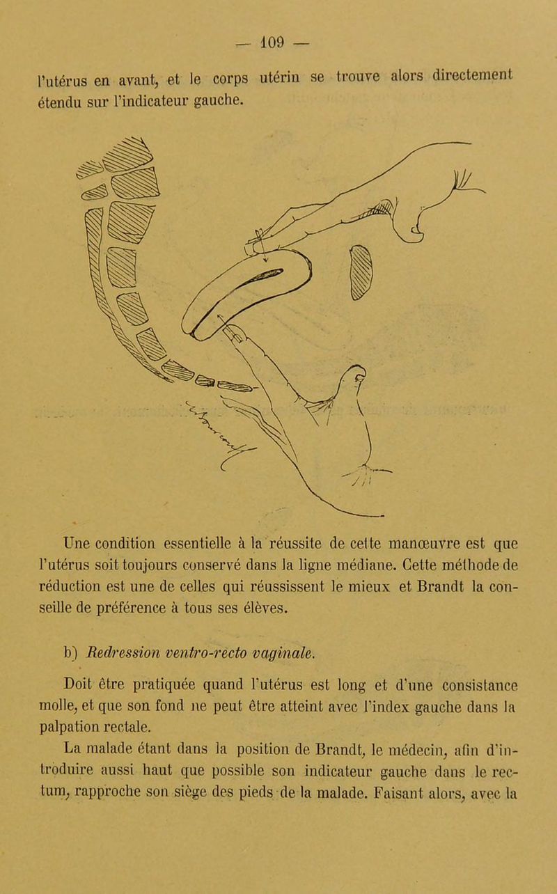 l’utérus en avant, et le corps utérin se trouve alors directement étendu sur l’indicateur gauche. Une condition essentielle à la réussite de cel te manœuvre est que l’utérus soit toujours conservé dans Ja ligne médiane. Cette méthode de réduction est une de celles qui réussissent le mieux et Brandt la con- seille de préférence à tous ses élèves. b) Redression ventro-recto vaginale. Doit être pratiquée quand l’utérus est long et d'une consistance molle, et que son fond ne peut être atteint avec l’index gauche dans la palpation rectale. La malade étant dans la position de Brandt, le médecin, afin d'in- troduire aussi haut que possible son indicateur gauche dans le rec- tum, rapproche son siège des pieds de la malade. Faisant alors, avec la