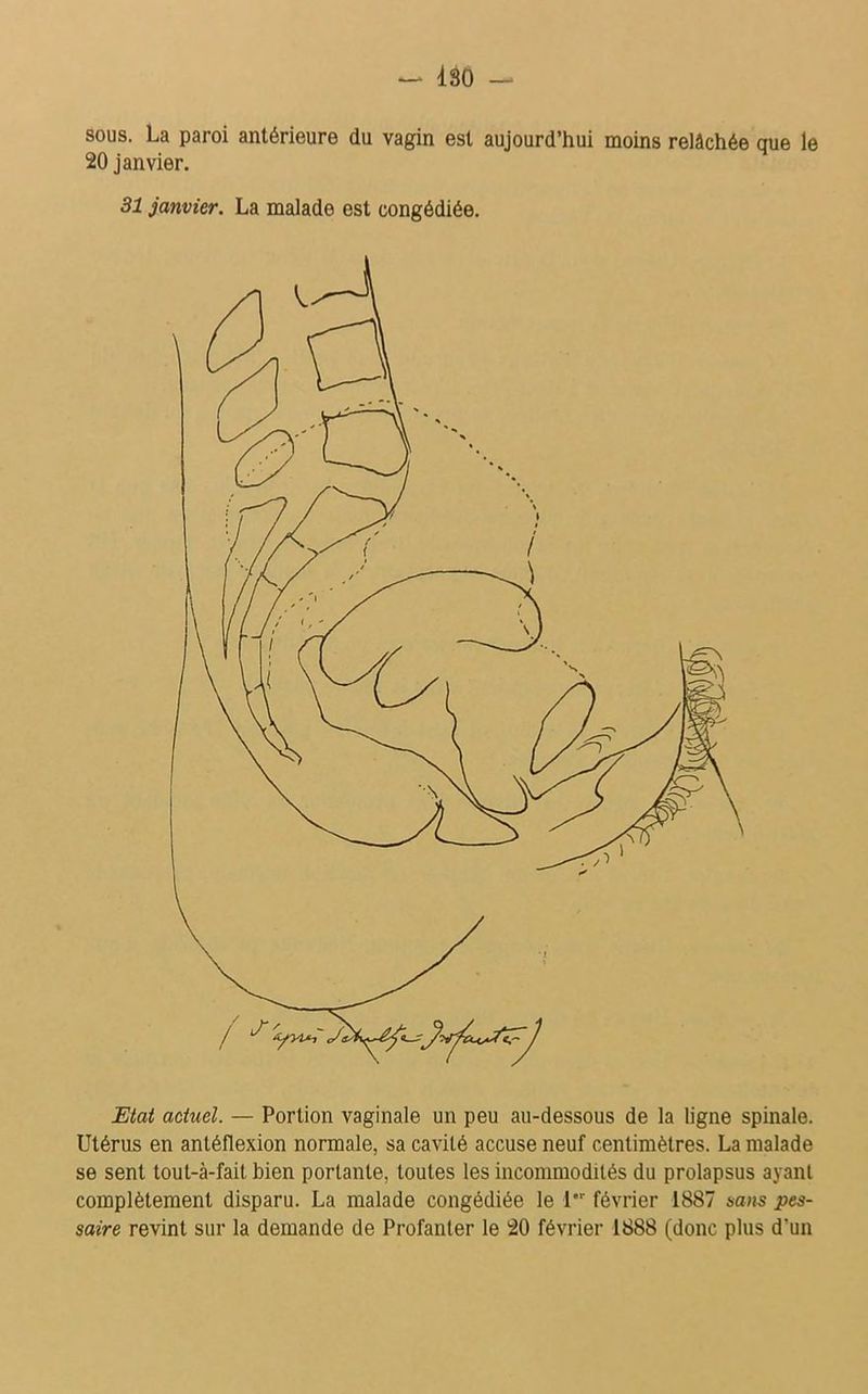 dso — sous. La paroi antérieure du vagin est aujourd’hui moins relâchée que le 20 janvier. 31 janvier. La malade est congédiée. Etat actuel. — Portion vaginale un peu au-dessous de la ligne spinale. Utérus en antéflexion normale, sa cavité accuse neuf centimètres. La malade se sent tout-à-fait bien portante, toutes les incommodités du prolapsus ayant complètement disparu. La malade congédiée le i,r février 1887 sans pes- saire revint sur la demande de Profanter le 20 février 1888 (donc plus d’un