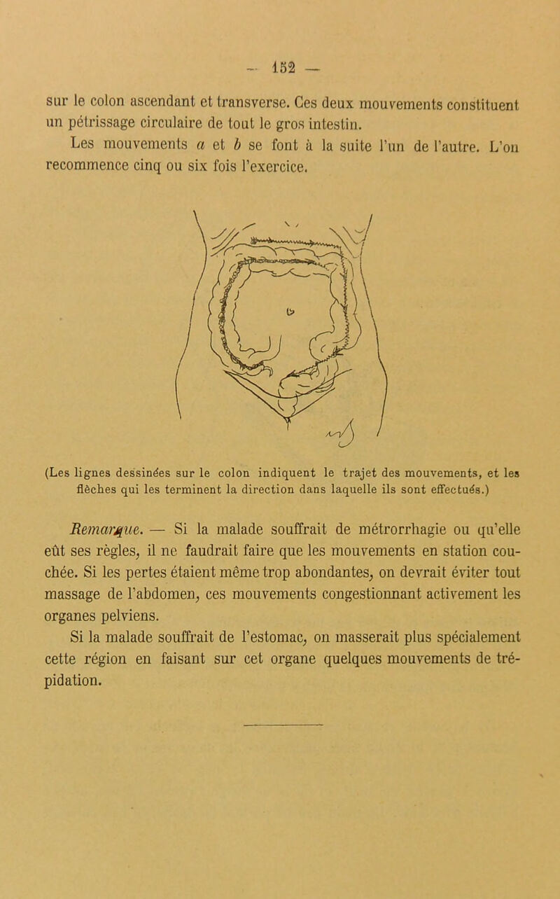 sur le colon ascendant et transverse. Ces deux mouvements constituent un pétrissage circulaire de tout le gros intestin. Les mouvements a et b se font à la suite l’un de l’autre. L’on recommence cinq ou six fois l’exercice. (Les lignes dessinées sur le colon indiquent le trajet des mouvements, et les flèches qui les terminent la direction dans laquelle ils sont effectués.) Remarque. — Si la malade souffrait de métrorrhagie ou qu’elle eût ses règles, il ne faudrait faire que les mouvements en station cou- chée. Si les pertes étaient même trop abondantes, on devrait éviter tout massage de l’abdomen, ces mouvements congestionnant activement les organes pelviens. Si la malade souffrait de l’estomac, on masserait plus spécialement cette région en faisant sur cet organe quelques mouvements de tré- pidation.