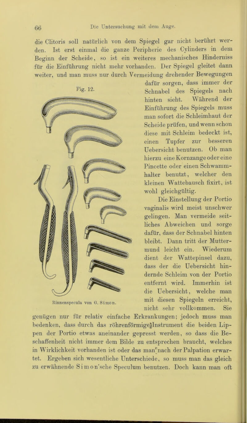 die Clitoris soll natürlich von dem Spiegel gar nicht berührt wer- den. Ist erst einmal die ganze Peripherie des Cylinders in dem Beginn der Scheide, so ist ein weiteres mechanisches Hinderniss für die Einführung nicht mehr vorhanden. Der Spiegel gleitet dann weiter, und man muss nur durch Vermeidung drehender Bewegungen dafür sorgen, dass immer der Flg- 12- Schnabel des Spiegels nach hinten sieht. Während der Einführung des Spiegels muss man sofort die Schleimhaut der Scheide prüfen, und wenn schon diese mit Schleim bedeckt ist, einen Tupfer zur besseren Uebersicht benutzen. Ob man hierzu eine Kornzange oder eine Pincette oder einen Schwamm- halter benutzt, welcher den kleinen Wattebausch fixirt, ist wohl gleichgültig. Die Einstellung der Portio vaginalis wird meist unschwer gelingen. Man vermeide seit- liches Abweichen und sorge dafür, dass der Schnabel hinten bleibt. Dann tritt der Mutter- mund leicht ein. Wiederum dient der Wattepinsel dazu, dass der die Uebersicht hin- dernde Schleim von der Portio entfernt wird. Immerhin ist die Uebersicht, welche man mit diesen Spiegeln erreicht, nicht sehr vollkommen. Sie genügen nur für relativ einfache Erkrankungen; jedoch muss man bedenken, dass durch das röhrenförmige^Instrument die beiden Lip- pen der Portio etwas aneinander gepresst werden, so dass die Be- schaffenheit nicht immer dem Bilde zu entsprechen braucht, welches in Wirklichkeit vorhanden ist oder das manUiach der Palpation erwar- tet. Ergeben sich wesentliche Unterschiede, so muss man das gleich zu erwähnende Simon'sche Speculum benutzen. Doch kann man oft Rinnenspecula von G. Simon.