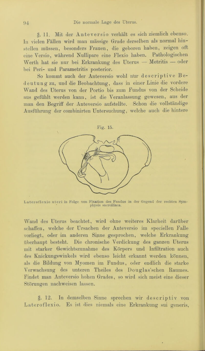§. 11. Mit der Anteversio verhält es sich ziemlich ebenso, ln vielen Fällen wird man mässige Grade derselben als normal hin- stellen müssen, besonders Frauen, die geboren haben, zeigen oft eine Versio, während Nullipare eine Flexio haben. Pathologischen Werth hat sie nur bei Erkrankung des Uterus — Metritis — oder bei Peri- und Parametritis posterior. So kommt auch der Anteversio wohl nür descriptive Be- deutung zu, und die Beobachtung, dass in einer Linie die vordere Wand des Uterus von der Portio bis zum Fundus von der Scheide aus gefühlt werden kann, ist die Veranlassung gewesen, aus der man den Begriff der Anteversio aufstellte. Schon die vollständige Ausführung der combinirten Untersuchung, welche auch die hintere Fig. 15. Laterol'lexio utevi in Folge von Fixation des Fundus in der Gegend der rechten Sym- • physis sacroiliaca. Wand des Uterus beachtet, wird ohne weiteres Klarheit darüber schaffen, welche der Ursachen der Anteversio im speciellen Falle vorliegt, oder im anderen Sinne gesprochen, welche Erkrankung überhaupt besteht. Die chronische Verdickung des ganzeu Uterus mit starker Gewichtszunahme des Körpers und Infiltration auch des Knickungswinkels wird ebenso leicht erkannt werden können, als die Bildung von Myomen im Fundus, oder endlich die starke Verwachsung des unteren Theiles des Douglas’schen Raumes. Findet man Anteversio hohen Grades, so wird sich meist eine dieser Störungen nachweisen lassen. §. 12. In demselben Sinne sprechen wir descriptiv von Lateroflexio. Es ist dies niemals eine Erkrankung sui generis,