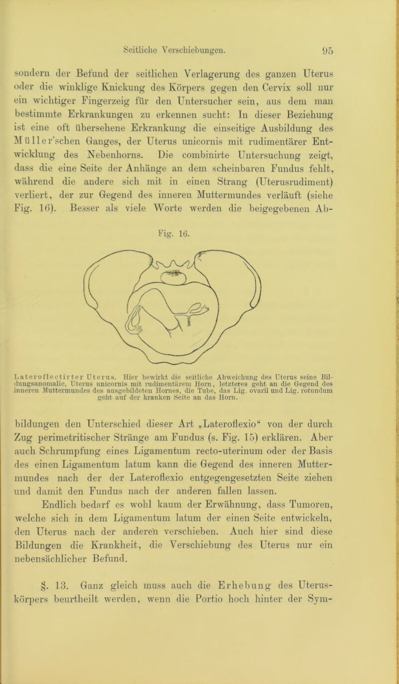 sondern der Befund der seitlichen Verlagerung des ganzen Uterus oder die winklige Knickung des Körpers gegen den Cervix soll nur ein wichtiger Fingerzeig für den Untersucher sein, aus dem man bestimmte Erkrankungen zu erkennen sucht: In dieser Beziehung ist eine oft übersehene Erkrankung die einseitige Ausbildung des M ü 11 e r’schen Ganges, der Uterus unicornis mit rudimentärer Ent- wicklung des Nebenhorns. Die combinirte Untersuchung zeigt, dass die eine Seite der Anhänge an dem scheinbaren Fundus fehlt, während die andere sich mit in einen Strang (Uterusrudiment) verliert, der zur Gegend des inneren Muttermundes verläuft (siehe Fig. 1(3). Besser als viele Worte werden die beigegebenen Ab- Fig. 16. Laterofleetirter Uterus. Hier bewirkt die seitliche Abweichung des Uterus seine Bil- dungsanomalie, Uterus unicornis mit rudimentärem Horn, letzteres geht an die Gegend des inneren Muttermundes des ausgebildeten Homes, die Tube, das Lig. ovarii und Lig. rotundum geht auf der kranken Seite an das Hom. bildungen den Unterschied dieser Art „Lateroflexio“ von der durch Zug perimetritischer Stränge am Fundus (s. Fig. 15) erklären. Aber auch Schrumpfung eines Ligamentum recto-uterinum oder der Basis des einen Ligamentum latum kann die Gegend des inneren Mutter- mundes nach der der Lateroflexio entgegengesetzten Seite ziehen und damit den Fundus nach der anderen fallen lassen. Endlich bedarf es wohl kaum der Erwähnung, dass Tumoren, welche sich in dem Ligamentum latum der einen Seite entwickeln, den Uterus nach der anderen verschieben. Auch hier sind diese Bildungen die Krankheit, die Verschiebung des Uterus nur ein nebensächlicher Befund. §. 13. Ganz gleich muss auch die Erhebung des Uterus- körpers beurtheilt werden, wenn die Portio hoch hinter der Sym-