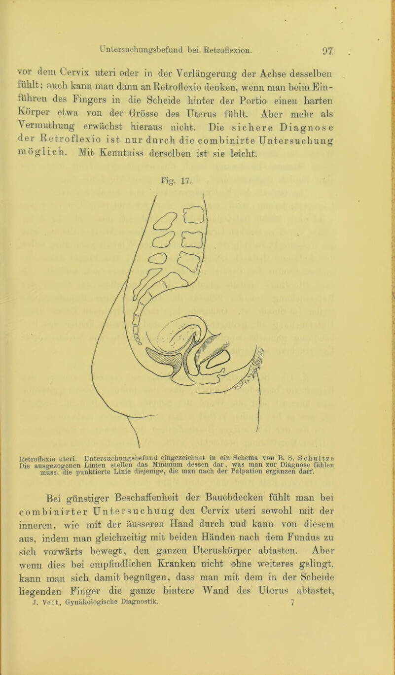 vor dein Cervix uteri oder in der Verlängerung der Achse desselben lühlt; auch kann man dann an lietroflexio denken, wenn man beim Ein- fuhren des Fingers in die Scheide hinter der Portio einen harten Körper etwa von der Grösse des Uterus fühlt. Aber mehr als Vermuthung erwächst hieraus nicht. Die sichere Diagnose der Retroflexio ist nur durch die combinirte Untersuchung möglich. Mit Kenntniss derselben ist sie leicht. Fig. 17. \ Retroflexio uteri. Untersuchungsbefund eingezeiclmet in ein Schema von B. S. Scliultze Die ausgezogenen Linien stellen das Minimum dessen dar, was man zur Diagnose fühlen muss, die punktierte Linie diejenige, die man nach der Palpation ergänzen darf. Bei o-ünstisfer Beschaffenheit der Bauchdecken fühlt man bei o o combinirter Untersuchung den Cervix uteri sowohl mit der inneren, wie mit der äusseren Hand durch und kann von diesem aus, indem man gleichzeitig mit beiden Händen nach dem Fundus zu sich vorwärts bewegt, den ganzen Uteruskörper abtasten. Aber wenn dies bei empfindlichen Kranken nicht ohne weiteres gelingt, kann man sich damit begnügen, dass man mit dem in der Scheide liegenden Finger die ganze hintere Wand des Uterus abtastet, J. Veit, Gynäkologische Diagnostik. 7