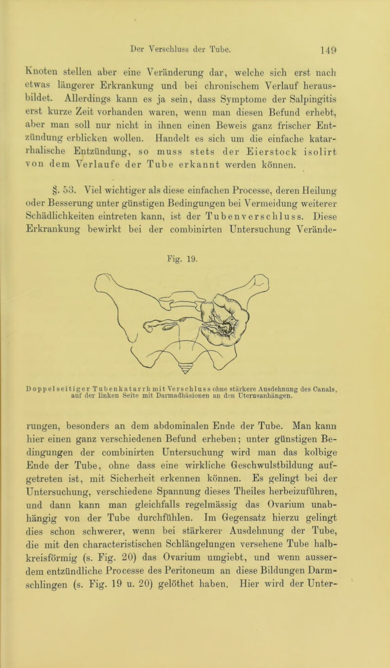 Knoten stellen aber eine Veränderung dar, welche sich erst nach etwas längerer Erkrankung und bei chronischem Verlauf heraus- bildet. Allerdings kann es ja sein, dass Symptome der Salpingitis erst kurze Zeit vorhanden waren, wenn man diesen Befund erhebt, aber man soll nur nicht in ihnen einen Beweis ganz frischer Ent- zündung erblicken wollen. Handelt es sich um die einfache katar- rhalische Entzündung, so muss stets der Eierstock isolirt von dem Verlaufe der Tube erkannt werden können. §. 53. Viel wichtiger als diese einfachen Processe, deren Heilung oder Besserung unter günstigen Bedingungen bei Vermeidung weiterer Schädlichkeiten eintreten kann, ist der Tubenverschluss. Diese Erkrankung bewirkt bei der combinirten Untersuchung Verände- Fig. 19. Doppelseitiger Tubenkatarrh mit Verschluss ohne stärkere Ausdehnung des Canals, auf der linken Seite mit Darmadhäsionen an den Uterusanhängen. rungen, besonders an dem abdominalen Ende der Tube. Man kann hier einen ganz verschiedenen Befund erheben; unter günstigen Be- dingungen der combinirten Untersuchung wird man das kolbige Ende der Tube, ohne dass eine wirkliche Geschwulstbildung auf- getreten ist, mit Sicherheit erkennen können. Es gelingt bei der Untersuchung, verschiedene Spannung dieses Theiles herbeizuführen, und dann kann man gleichfalls regelmässig das Ovarium unab- hängig von der Tube durchfühlen. Im Gegensatz hierzu gelingt dies schon schwerer, wenn bei stärkerer Ausdehnung der Tube, die mit den characteristischen Schlängelungen versehene Tube halb- kreisförmig (s. Fig. 20) das Ovarium umgiebt, und wenn ausser- dem entzündliche Processe des Peritoneum an diese Bildungen Darm- schlingen (s. Fig. 19 u. 20) gelöthet haben. Hier wird der Unter-