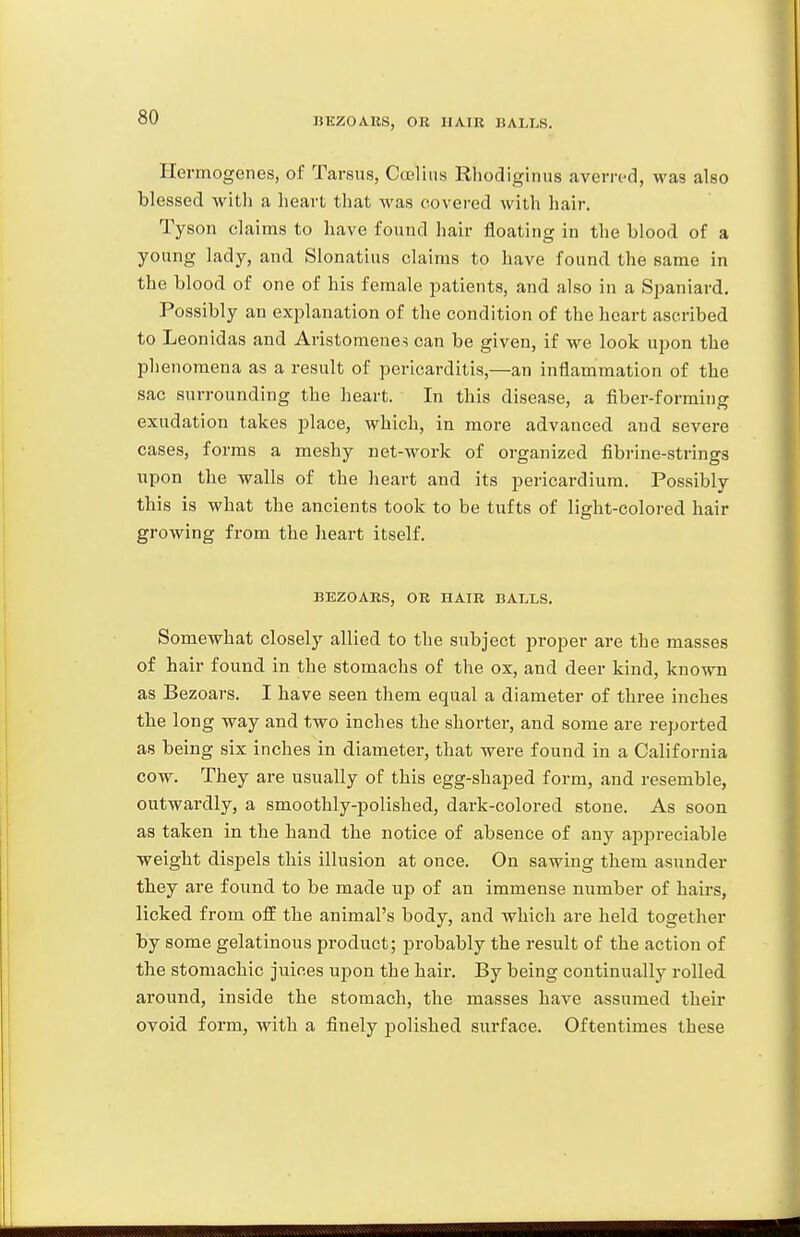 Hermogenes, of Tarsus, Cuslins Rhodiginus avem-d, was also blessed witli a heart that was covered with hair. Tyson claims to have found hair floating in the blood of a young lady, and Slonatius claims to have found the same in the blood of one of his female jjatients, and also in a Spaniard. Possibly an explanation of the condition of the heart ascribed to Leonidas and Aristomene^ can be given, if we look upon the phenomena as a result of pericarditis,—an inflammation of the sac surrounding the heart. In this disease, a fiber-forming exudation takes place, which, in more advanced and severe cases, forms a meshy net-work of organized fibrine-strings upon the walls of the heart and its pericardium. Possibly this is what the ancients took to be tufts of light-colored hair growing from the heart itself. BEZOAES, OR HAIR BALLS. Somewhat closely allied to the subject proper are the masses of hair found in the stomachs of the ox, and deer kind, known as Bezoars. I have seen them equal a diameter of three inches the long way and two inches the shorter, and some are reported as being six inches in diameter, that were found in a California cow. They are usually of this egg-shaped form, and resemble, outwardly, a smoothly-polished, dark-colored stone. As soon as taken in the hand the notice of absence of any appreciable weight dispels this illusion at once. On sawing them asunder they are found to be made up of an immense number of hairs, licked from off the animal's body, and which are held together by some gelatinous product; probably the result of the action of the stomachic juices upon the hair. By being continually rolled around, inside the stomach, the masses have assumed their ovoid form, with a finely polished surface. Oftentimes these