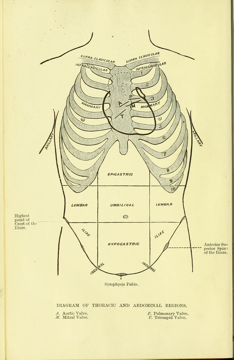 A. Aortic Valve. M. Mitral Valve. P. Pulmonary Valve. T. Tricuspid Valve.