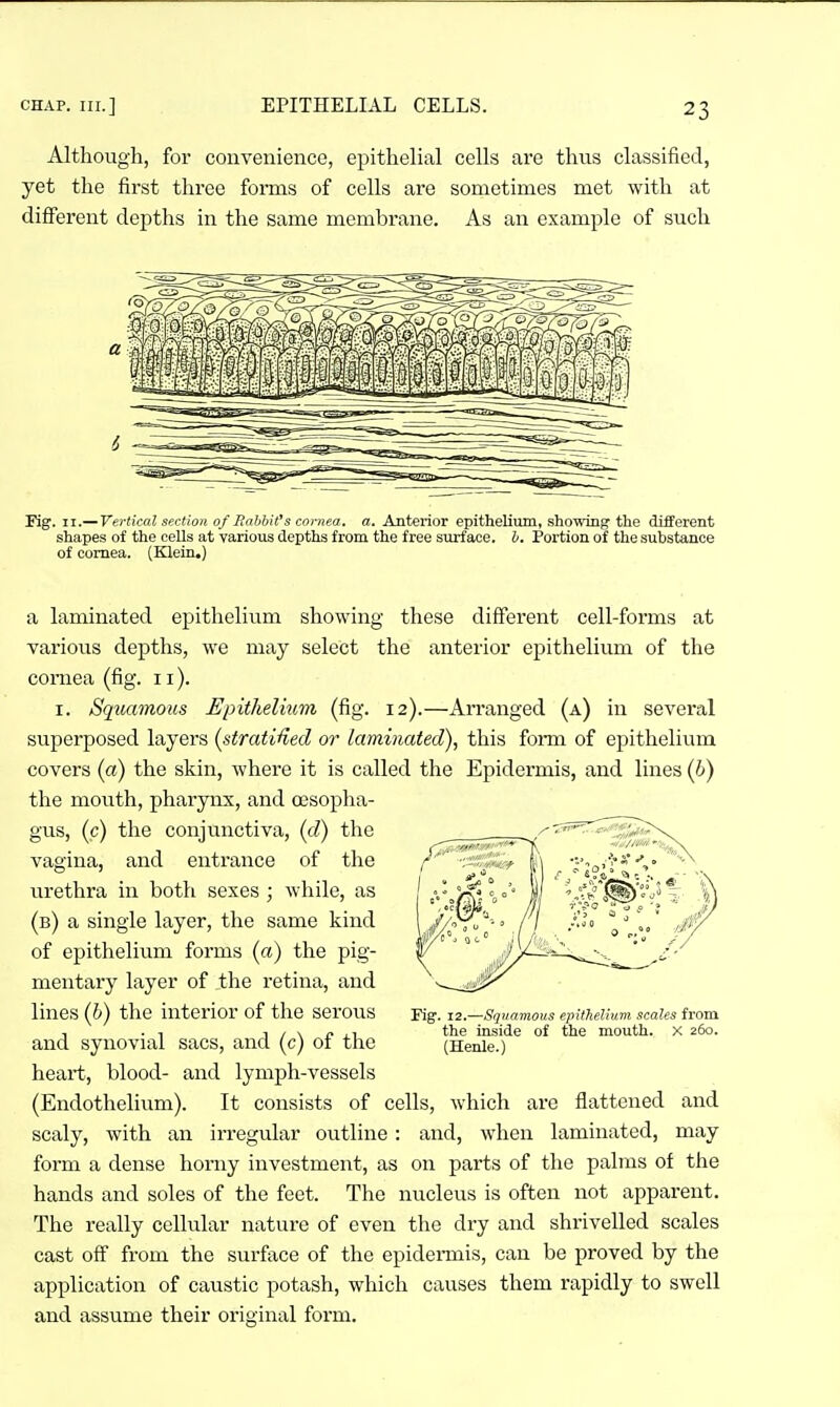 Although, for convenience, epithelial cells are thus classified, yet the first three forms of cells are sometimes met with at different depths in the same membrane. As an example of such Fig. II.— Vertical section of Bahhit's cornea, a. Anterior epithelium, showing the different shapes of the cells at various depths from the free surface. I. Portion of the substance of cornea. (Klein.) a laminated epithelium showing these different cell-forms at various depths, we may select the anterior epithelium of the cornea (fig. 11). I. Sq^Kimous Epithelium (fig. 12).—Arranged (a) in several superposed layers {stratHied or laminated), this fomi of epithelium covers {a) the skin, where it is called the Epidermis, and lines (6) the mouth, phai'ynx, and oesopha- gus, (c) the conjunctiva, (d) the vagina, and entrance of the urethra in both sexes ; while, as (b) a single layer, the same kind of epithelium forms (a) the pig- mentaiy layer of the retina, and lines (h) the interior of the serous and synovial sacs, and (c) of the heart, blood- and lymph-vessels (Endothelium). It consists of cells, which are flattened and scaly, with an irregular outline: and, when laminated, may form a dense horny investment, as on parts of the palms of the hands and soles of the feet. The nucleus is often not apparent. The really cellular nature of even the dry and shrivelled scales cast off from the surface of the epidermis, can be proved by the application of caustic potash, which causes them rapidly to swell and assume their original form. Fig. 12.—Squamous epithelium scales from the inside of the mouth. X 260. (Henle.)
