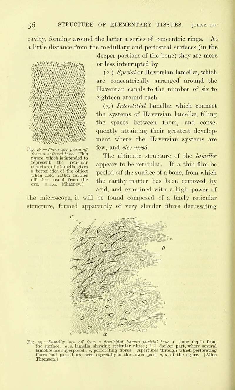 cavity, forming around the latter a series of concentric rings. At a little distance from the medullary and periosteal surf;xces (in the deeper portions of the bone) they are more or less interrnpted by (2.) /Speaa^ or Haversian lamellfE, which are concentrically arranged aronnd the Haversian canals to the number of six to eighteen around each. (3.) Interstitial lamellcB, Avhich connect the systems of Haversian lamellae, filling the spaces between them, and conse- quently attaining their greatest develop- ment where the Haversian systems are few, and vice versd. The ultimate structure of the lamella; appears to be reticular. If a thin film be peeled oft' the surface of a bone, from which the earthy matter has been removed by acid, and examined with a high power of the microscope, it will be found composed of a finely reticular stnicture, formed apparently of very slender fibres decussating Fig. 49.—Lamella torn off from a decalcifcd Tiumnn parietal lone at some depth from the siirface. a, a lamella, showing reticular fibres ; J, ft, darker part, where several lamellfe are superposed ; c, perforating fibres. Apertures through which perforating fibres had passed, are seen especially in the lower part, a, a, of the figure. (Allen Thomson.) Fig. 48.—Thin layer peeled off from a so ftened hone. This flgrure, wiich is intended to represent the reticular structure of a lamella, gives a better idea of the object when held rather farther off than usual from the eye. X 400. (Sharpey.)