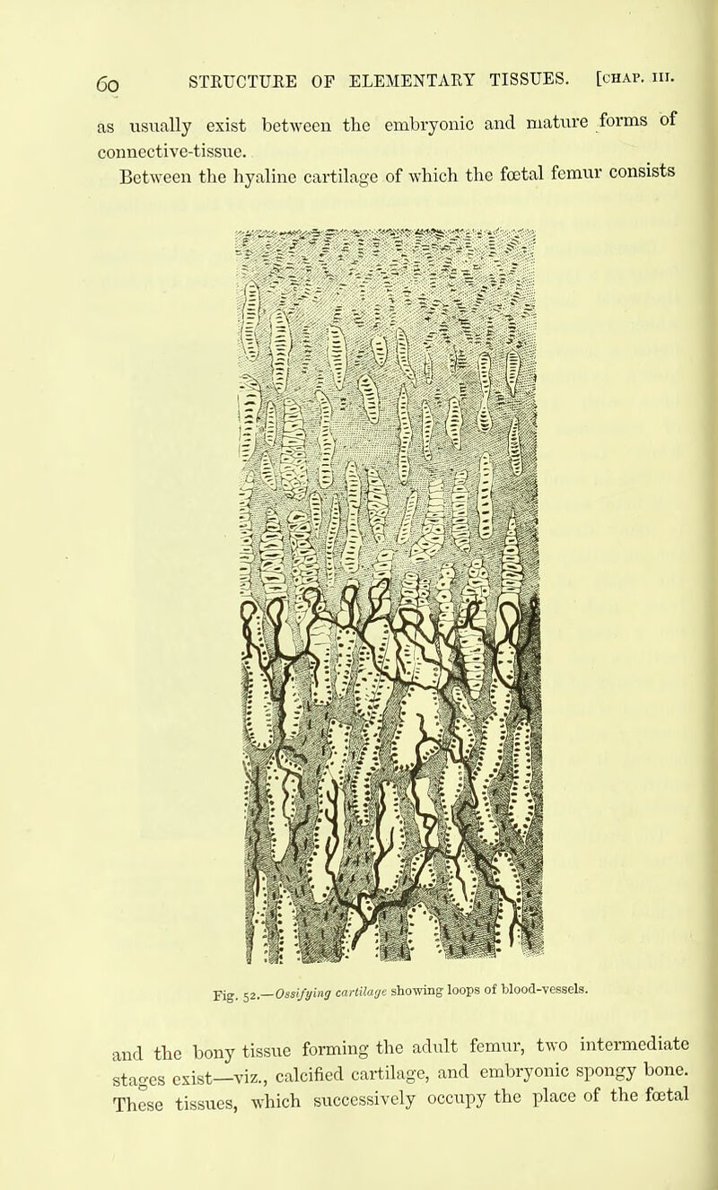 as usually exist between the embryonic and mature forms of connective-tissue. Between the hyaline cartilage of which the foetal femur consists pig^ ^2—Ossifying carlilarje showing loops of blood-vessels. and the bony tissue forming the adiilt femur, two intermediate stages exist—viz., calcified cartilage, and embryonic spongy bone. These tissues, which successively occupy the place of the foetal