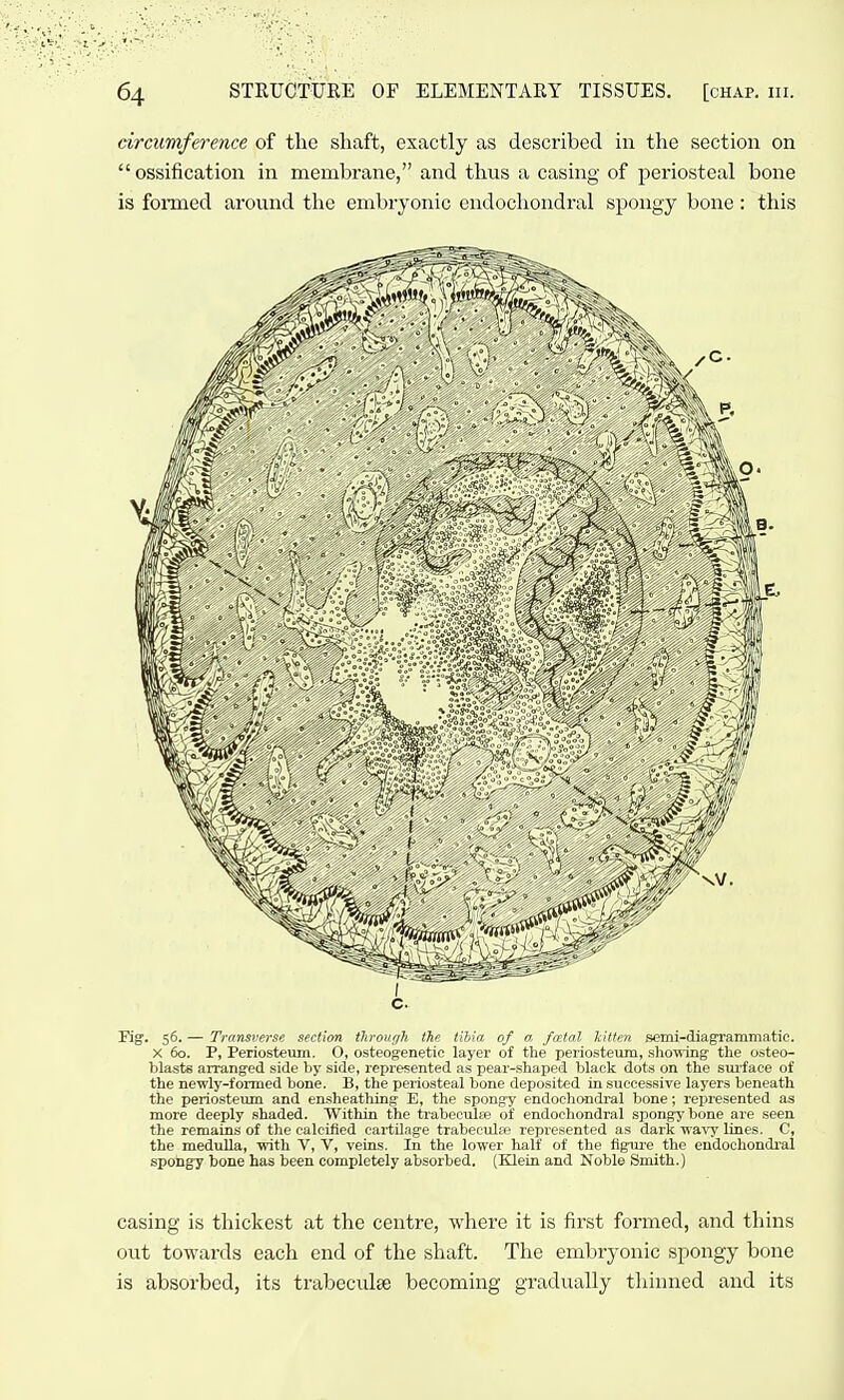 circumference of the shaft, exactly as described in the section on ossification in membrane, and thus a casing of periosteal bone is formed around the embryonic endochondral spongy bone: this Kg. 56. — Transverse section through the tihia of a fatal kitten semi-diagrammatic. X 60. P, Periosteum. O, osteogenetio layer of the periosteum, shoning the osteo- blasts arranged side by side, represented as pear-shaped black dots on the sui'face of the newly-formed bone. B, the periosteal bone deposited in successive layers beneath the periosteum and ensheathing E, the spongy endochondral bone; rejiresented as more deeply shaded. Within the trabeculse of endochondral spongy bone are seen the remains of the calcified cartilage trabeculie repref^r nti il us dark wa^-)'lines. C, the medulla, with V, V, veins. In the lower lialf of tlic figure the eudochondiul spongy bone has been completely absorbed. (Klein and Noble Smith.) casing is thickest at the centre, where it is first formed, and thins out towards each end of the shaft. The embryonic spongy bone is absorbed, its trabeculse becoming gradually thinned and its