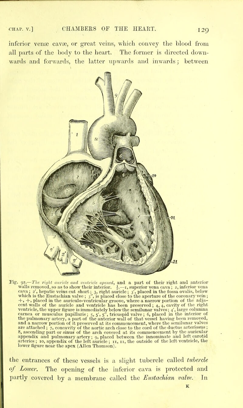 inferior vense cavte, or great veins, which convey the blood from iill parts of the body to tlie heart. The former is directed down- wards and forwards, tlie hxtter upwards and inwards; between Fig. 92.—The ri'/ht luiride and ventricle opened, and a part ot their right and anterior walls removed, so as to show theii' interior, h—i, superior vena cava; 2, inferior vena cava; 2', hepatic veins cut short; 3, right auricle; 3', placed in the fossa ovalis, below which is the Eustachian valve ; 3, is placed close to the aperture of the coronai-y vein; +, +, placed in the auriculo-ventricular groove, where a narrow portion of the adja- cent walls of the aiu'icle and ventricle has heen preserved; 4, 4, cavity of the right ventricle, the upper figure is immediately below the semilimar valves; 4', large colunma eamea or musculus papillaris; 5, 5', 5, tricuspid valve; 6, placed in the interior of the pulmonary artei-y, a part of the anterior wall of that vessel having been removed, and a narrow portion of it preserved at its commencement, where the semilunar valves are attached ; 7, concavity of the aortic arch close to the cord of the ductus arteriosus; 8, ascending part or sinus of the arch covered at its commencement by the auricular appendix and pulmonary artery; 9, placed between the innominate and left carotid arteries ; 10, appendix of the left auricle ; 11, 11, the outside of the left ventricle, the lower flgui'e near the apex (Allen Thomson). the entrances of these vessels is a slight tubercle called tubercle of Lower. The opening of the inferior cava is protected and partly covered by a membrane called the Eustachian valve. In