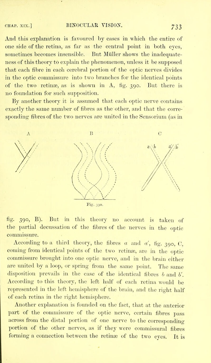 And this explanation is favoured by cases in which the entire f)f one side of the retina, as far as the central point in both eves, sometimes becomes insensible. But Miiller shows the inadeqiiate- ness of this tlieory to explain the phenomenon, unless it lie siipposed that cacli fil)rc in eaoli cerebral portion of the optic nerves divides in the optic commissure into two branches for tlie identical points of tlie two retina3, as is shown in A, fig. 390. But there is no foundation for such supposition. By another theory it is assumed tliat each optic nerve contains exactly the same number of fibres as the other, and that the corre- sponding fibres of the two nerves are united in the Sensorium (as in A B C Fig-. J90. fig. 390, B). B\it in tliis theory no account is taken of the partial decussation of the fibres of the nerves in the optic commissure. According to a tliird theory, the fibres a and a, fig. 390, C, coming from identical points of the two retinte, are in the optic commissure brought into one optic nerve, and in the brain either ai'e united by a loop, or spring from the same point. The same disposition prevails in the case of the identical fibres h and V. According to this theory, the left half of each retina would be represented in the left hemisphere of the brain, and tiie right half of each retina in tlie right hemisphere. Another explanation is founded on the fact, tliat at the anterior part of the connaissure of the optic nerve, certain fibres pass across from the distal portion of one nerve to the corresponding portion of the otlier nerves, as if they were commissural fibres forming a connection lietween the retina; of the two eyes. It is