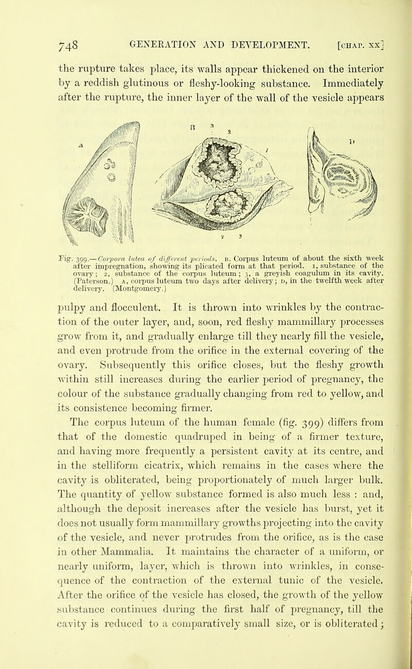 the rupture takes place, its walls appear thickened on the interior by a reddish glutinous or fleshy-looking substance. Immediately after the rupture, the inner layer of the wall of tlie vesicle appears Pig. 399.— Corpora lutea of different periods. B. Corpus luteum of about the sixth week after impregnation, showing its plicated form at that period, i, substance of the ovary; 2, substance of the corpus luteum; 3, a greyish coagulum in its cavity. (Paterson.) A, coipus luteum two days after deliveiy; u, in the twelfth week after delivery. (Montgomei-y.) pulpy and flocculent. It is thrown into wrinkles by the contrac- tion of the outer layer, and, soon, red fleshy manimillary processes grow from it, and gradually enlarge till they nearly fill the vesicle, and eveir protrude from the orifice in the external covering of the ovary. Subsequently this orifice closes, but the fleshy growth within still increases during the earlier period of pregnancy, the colour of the substance gradually changing from red to yellow, and its consistence becoming firmer. The corpus luteum of the human female (fig. 399) differs from that of the domestic quadruped in being of a firmer texture, and having more frequently a persistent cavity at its centre, and in the stelliform cicatrix, which remains in the cases where the cavity is obliterated, being propoi'tionately of much larger bulk. The quantity of yellow substance formed is also much less : and, although the deposit increases after the vesicle has burst, yet it does not usually form manimillary growths projecting into the cavity of the vesicle, and never protrudes from the orifice, as is the case in other Mammalia. It maintains the character of a uniform, or nearly uniform, layer, which is thrown into Avrinkles, in conse- quence of the contraction of the external tunic of the vesicle. After the orifice of the vesicle has closed, the growth of the yellow substance continues during the first half of pregnancy, till the cavity is reduced to a comparatively small size, or is obliterated;