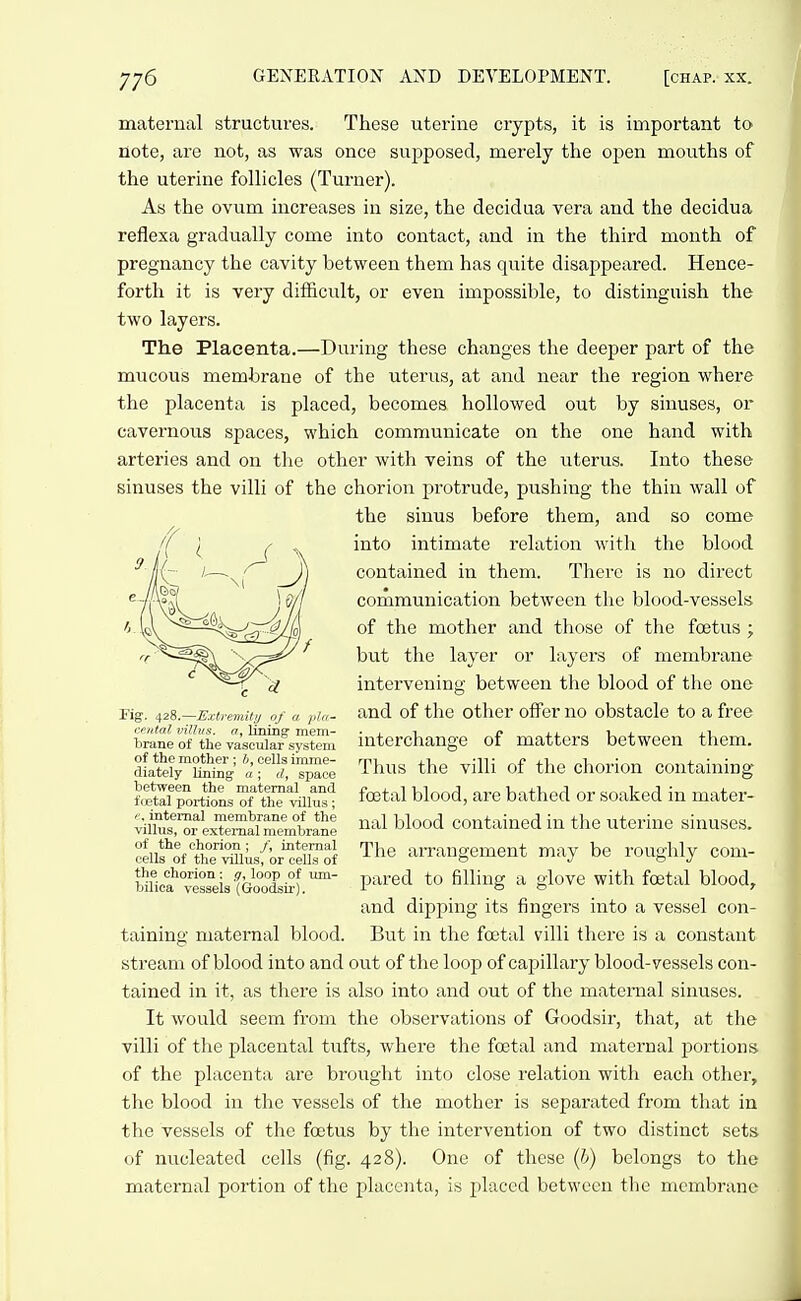 matei'nal structures. These uterine crypts, it is important to note, are not, as was once supposed, merely the open mouths of the uterine follicles (Turner). As the ovum increases in size, the decidua vera and the decidua reflexa gradually come into contact, and in the third month of pregnancy the cavity between them has quite disappeared. Hence- forth it is very difficult, or even impossible, to distinguish the two layers. The Placenta.—During these changes the deeper part of the mucous membrane of the uterus, at and near the region where the placenta is placed, becomes hollowed out by sinuses, or cavernous spaces, which communicate on the one hand with arteries and on the other with veins of the uterus. Into these sinuses the villi of the chorion protrude, pushing the thiu wall of the sinus before them, and so come into intimate relation with the blood contained in them. There is no direct communication between the blood-vessels of the mother and those of the foetus ; but the layer or layers of membrane intervening between the blood of the one and of the other offer no obstacle to a free interchange of matters between them. Thus the villi of the chorion containing foetal blood, are bathed or soaked in mater- nal blood contained in the uterine sinuses. The arrangement may be roughly com- pared to filling a glove with foetal blood, and dipping its fingers into a vessel con- But in the foetal villi there is a constant stream of blood into and out of the loop of capillary blood-vessels con- tained in it, as there is also into and out of the maternal sinuses. It would seem from the observations of Goodsir, that, at the villi of the placental tufts, where the foetal and maternal portions of the placenta are brouglit into close relation with each other, the blood in the vessels of the mother is separated from that in the vessels of the foetus by the intervention of two distinct sets of nucleated cells (fig. 428). One of these (i) belongs to the maternal portion of the placenta, is placed between the membrane Fig. 428.—Extremity of a pla- v.f utal vilhis. a, lining mem- brane of the vascular system of the mother; b, cells imme- diately lining a ; d, space between the maternal and fietal portions of the villus; internal membrane of the villus, or external membrane of the chorion ; /, internal cells of the villus, or cells of the chorion: g, loop of um- bilica vessels (Goodsir). taining maternal blood.