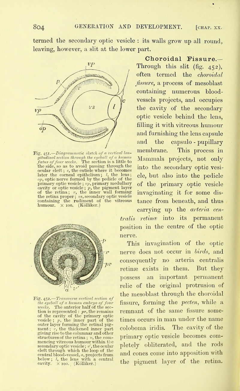 termed the secondary optic vesicle : its walls grow up all round, leaving, however, a slit at the lower part. Choroidal Fissure.— Fig. n^i.—Diogrammatlc sketch of a vertical lon- gitudinal section through the eijeball of a human foetus of four weeks. The section is a little to the side, so as to avoid passing- through the ocular cleft; c, the cuticle where it becomes later the corneal epithelium; /, the lens; op, optic nerve formed by the pedicle of the primary optic vesicle ; vp, primary medullary cavity or optic vesicle ; p, the pigment layer of the retina; r, the inner wall forming the retina proper; vs, secondary optic vesicle containing the rudiment of the vitreous humoTir. x loo. (KoUiker.) Fig. 452.—Trousverse vertical section of the eyebaV of a, human emhryo of four weeis. The anterior half of the sec- tion is represented : -pr, the remains of the cavity of the primary optic vesicle ; p, the inner part of the outer layer forming the retinal pig- ment ; r, the thickened inner part giving rise to the columnar and other structures of the retina; v, the com- mencing vitreous humour within the secondary optic vesicle; the ocular cleft through which the loop of the central blood-vessel, a, projects from below; /, the lens with a central cavity. X 100. (KuUiker.) Through this slit (fig. 452), often termed the choroidal fissure, a process of mesoblast containing numerous blood- vessels projects, and occupies the cavity of the secondary optic vesicle behind the lens, filling it with vitreous humovir and furnishing the lens capsule and the capsulo - pupillary membrane. This process in Mammals projects, not only into the secondary optic vesi- cle, but also into the pedicle of the primary optic vesicle invaginating it for some dis- tance from beneath, and thus carrying up the arteria cen- traJis retmce into its permanent position in the centre of the optic nerve. This invagination of the optic nerve does not occur in birds, and consequently no arteria centralis retinee exists in them. But they possess an important permanent relic of the original protrusion of the mesoblast through the choroidal fissure, forming the pecten, while a remnant of the same fissure some- times occurs in man under the name coloboma iridis. The cavity of the primary optic vesicle becomes com- pletely obliterated, and the rods and cones come into apposition with the pigment layer of the retiua.