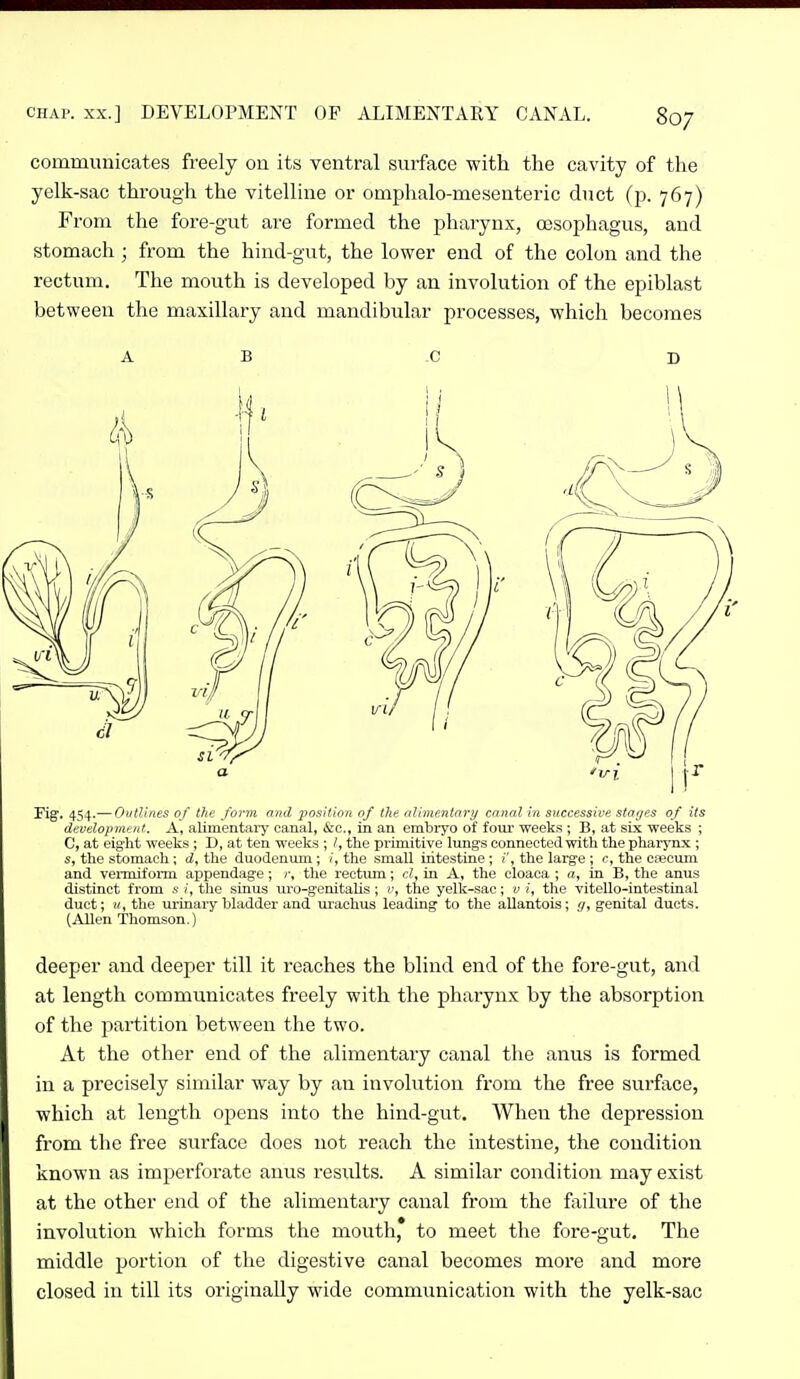 CHAP. XX.] DEVELOPMENT OP ALIMENTARY CANAL. communicates freely on its ventral surface with the cavity of the yelk-sac through the vitelline or omphalo-mesenteric duct (p. 767) From the fore-gut are formed the pharynx, oesophagus, and stomach ■ from the hind-gut, the lower end of the colon and the rectum. The mouth is developed by an involution of the epiblast between the maxillary and mandibular processes, which becomes ABC D Fig. 454.— OiitUnes of the form and position of the ajbnentary cnnnl hi successive stoijes of its development. A, alimentaiy canal, &c., in an embryo of four weeks ; B, at six weeks ; C, at eight weeks ; D, at ten weeks ; I, the primitive lungs connected with the pharj'nx ; s, the stomach; d, the duodenum ; i, the small intestine ; (', the large ; c, the Cfecum and venniform appendage; /•, the rectum; cl, in A, the cloaca ; a, in B, the anus distinct from * (, the sinus uro-genitalis ; v, the yelk-sac; v i, the vitello-intestinal duct; u, the urinary bladder and ui'achus leading to the allantois; </, genital ducts. (Allen Thomson.) deeper and deeper till it reaches the blind end of the fore-gut, and at length communicates freely with the pharynx by the absorption of the partition between the two. At the other end of the alimentary canal tiie anus is formed in a precisely similar way by an involution from the free surface, which at length opens into the hind-gut. When the depression from the free surface does not reach the intestine, the condition known as imperforate anus results. A similar condition may exist at the other end of the alimentary canal from the failure of the involution which forms the mouth,* to meet the fore-gut. The middle portion of the digestive canal becomes more and more closed in till its originally wide communication with the yelk-sac