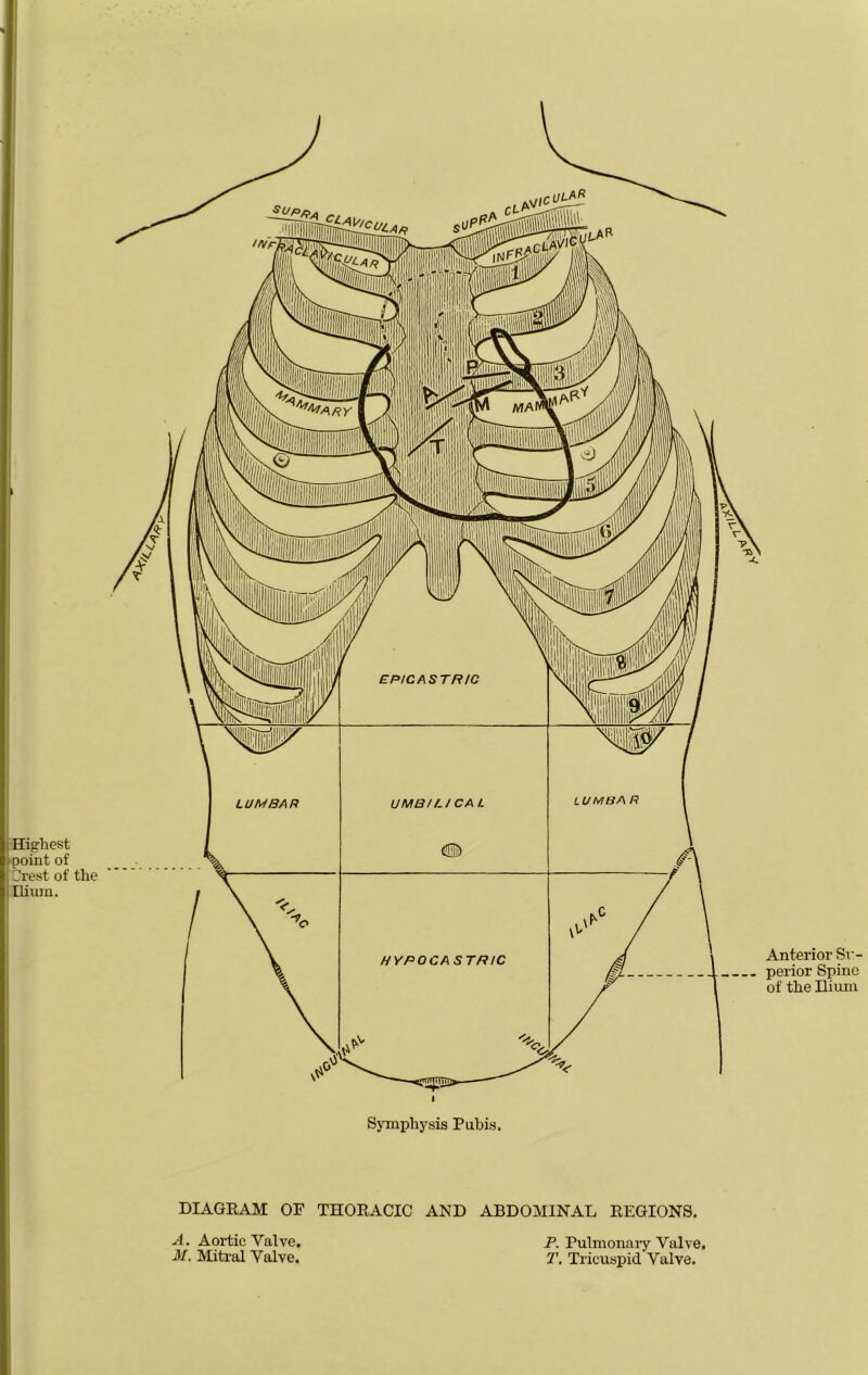 Highest point of rest of the Hium. DIAGRAM OF THORACIC AND ABDOMINAL REGIONS. A. Aortic Valve. P. Pulmonary Valve. M. Mitral Valve. T. Tricuspid Valve.