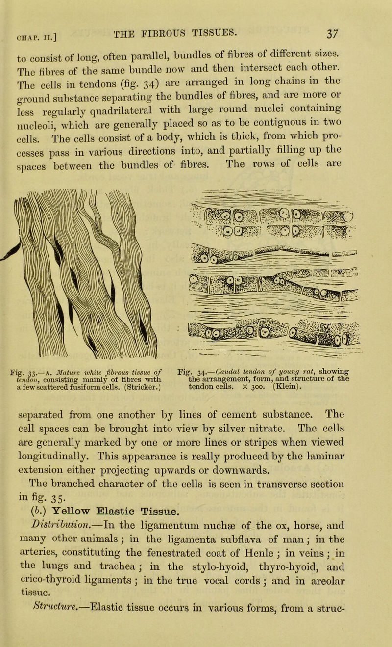 to consist of long, often parallel, bundles of fibres of different sizes. The fibres of the same bundle now and then intersect each other. The cells in tendons (fig. 34) are arranged in long chains in the ground substance separating the bundles of fibres, and are more or less regularly quadrilateral with large round nuclei containing nucleoli, which are generally placed so as to be contiguous in two cells. The cells consist of a body, which is thick, from which pro- cesses pass in various directions into, and partially filling up the spaces between the bundles of fibres. The rows of cells are Fig. 33.—A. Mature white fibrous tissue of tendon, consisting mainly of fibres with a few scattered fusiform cells. (Strieker.) Fig. 34.—Caudal tendon of young rat, showing the arrangement, form, and structure of the tendon cells, x 300. (Klein). separated from one another by lines of cement substance. The cell spaces can be brought into view by silver nitrate. The cells are generally marked by one or more lines or stripes when viewed longitudinally. This appearance is really produced by the laminar extension either projecting upwards or downwards. The branched character of the cells is seen in transverse section in %• 35- (6.) Yellow Elastic Tissue. Distribution.—In the ligamentum nuchse of the ox, horse, and many other animals ; in the ligamenta subflava of man; in the arteries, constituting the fenestrated coat of Henle ; in veins; in the lungs and trachea; in the stylo-hyoid, thyro-hyoid, and crico-thyroid ligaments; in the true vocal cords; and in areolar tissue. Structure.—Elastic tissue occurs in various forms, from a struc-