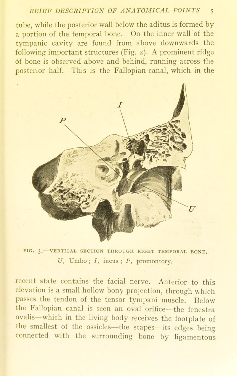 tube, while the posterior wall below the aditus is formed by a portion of the temporal bone. On the inner wall of the tympanic cavity are found from above downwards the following important structures (Fig. 2). A prominent ridge of bone is observed above and behind, running across the posterior half. This is the Fallopian canal, which in the FIG. 3. VERTICAL SECTION THROUGH RIGHT TEMPORAL BONE. U, Umbo ; /, incus ; P, promontory. recent state contains the facial nerve. Anterior to this elevation is a small hollow bony projection, through which passes the tendon of the tensor tympani muscle. Below the Fallopian canal is seen an oval orifice—the fenestra ovalis—which in the living body receives the footplate of the smallest of the ossicles—the stapes—its edges being connected with the surrounding bone by ligamentous