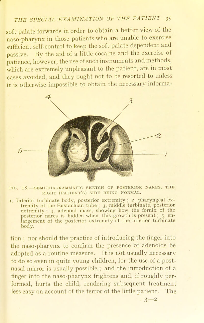 soft palate forwards in order to obtain a better view of the naso-pharynx in those patients who are unable to exercise sufficient self-control to keep the soft palate dependent and passive. By the aid of a little cocaine and the exercise of patience, however, the use of such instruments and methods, which are extremely unpleasant to the patient, are in most cases avoided, and they ought not to be resorted to unless it is otherwise impossible to obtain the necessary informa- FIG. 18.—SEMI-DIAGRAMMATIC SKETCH OF POSTERIOR NARES, THE RIGHT (Patient's) side being normal. I, Inferior turbinate body, posterior extremity; 2, pharyngeal ex- tremity of the Eustachian tube ; 3, middle turbinate, posterior extremity ; 4, adenoid mass, showing how the fornix of the posterior nares is hidden when this growth is present ; 5, en- largement of the posterior extremity of the inferior turbinate body. tion ; nor should the practice of introducing the finger into the naso-pharynx to confirm the presence of adenoids be adopted as a routine measure. It is not usually necessary to do so even in quite young children, for the use of a post- nasal mirror is usually possible ; and the introduction of a finger into the naso-pharynx frightens and, if roughly per- formed, hurts the child, rendering subsequent treatment less easy on account of the terror of the little patient. The 3—2