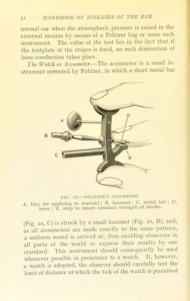 normal ear when the atmospheric pressure is raised in the external meatus by means of a Politzer bag or some such instrument. The value of the test lies in the fact that if the footplate of the stapes is fixed, no such diminution of bone-conduction takes place. The Watch or Acoiimeter.—The acoumeter is a small in- strument invented by Politzer, in which a short metal bar FIG. 20. POLITZER'S acoumeter. A Disc for applying to mastoid ; B, hammer ; C, metal bar ; D, lever ; E, stop to insure constant strength of stroke. (Fig. 20, C) is Struck by a small hammer (Fig. 20, B), and, as all acoumeters are made exactly to the same pattern, a uniform sound is arrived at, thus enabling observers in all parts of the world to express their results by one standard. This instrument should consequently be used whenever possible in preference to a watch. If, however, a watch is adopted, the observer should carefully test the limit of distance at which the tick of the watch is perceived